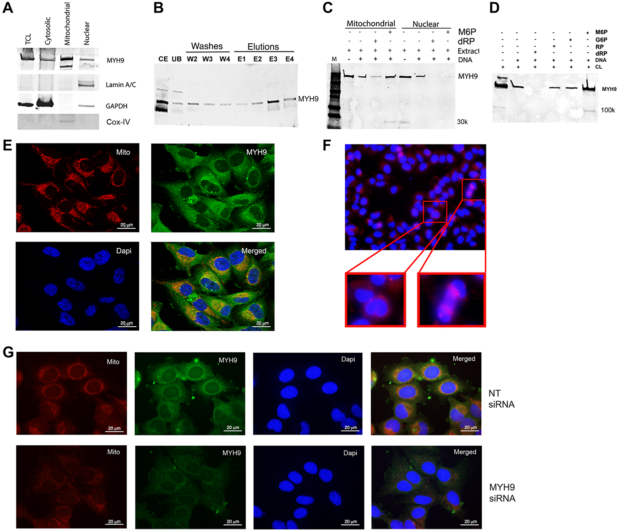 Intracellular localization of MYH9