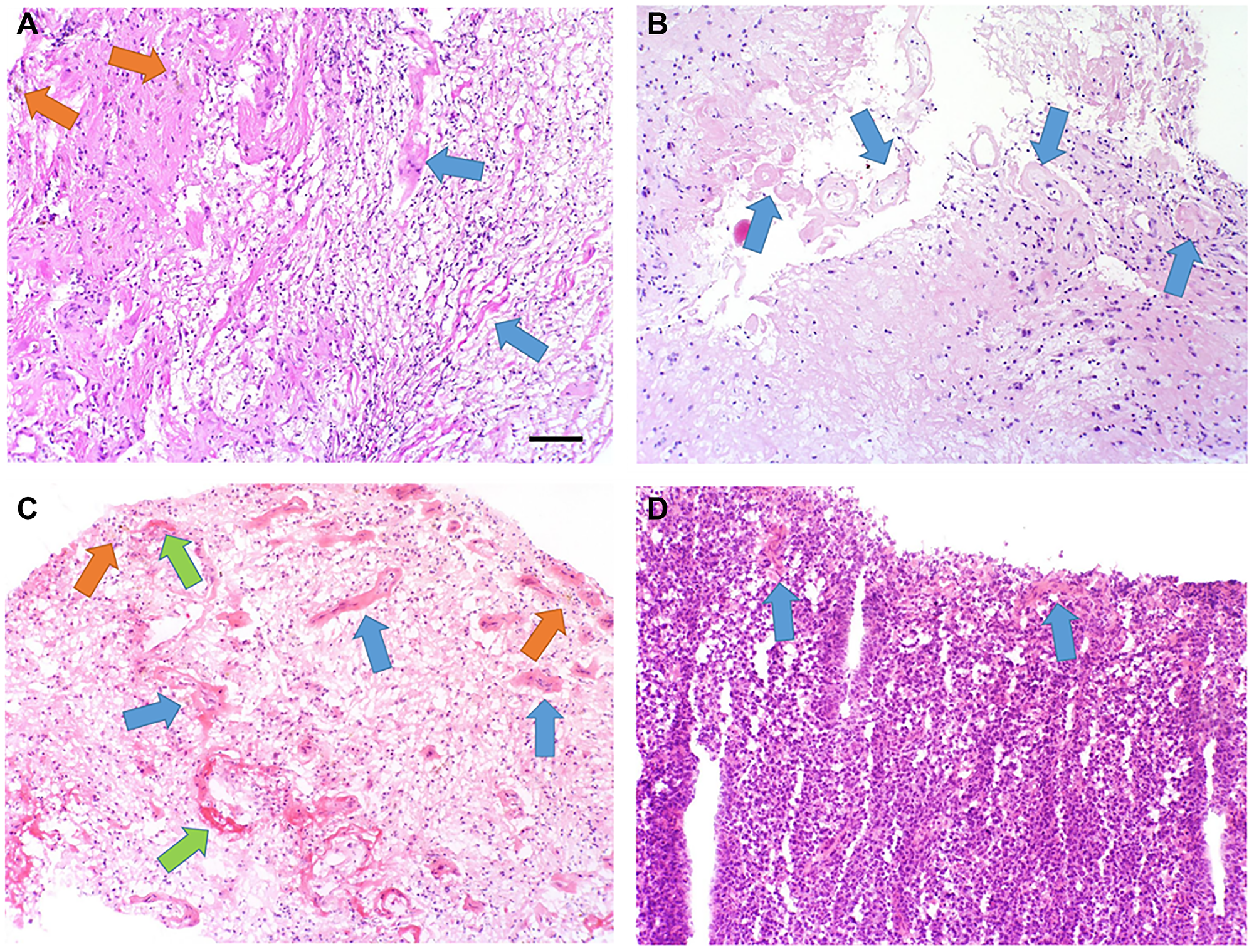 Pathology results