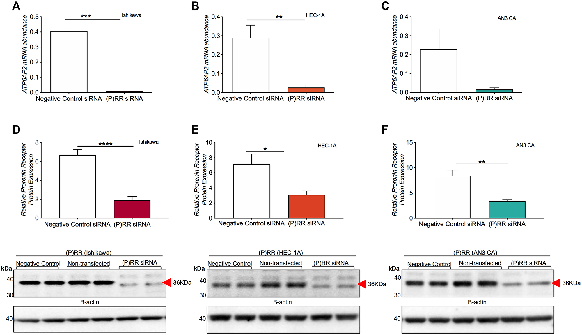 siRNA knockdown of ATP6AP2 gene and protein ((P)RR) expression in endometrial epithelial cancer cell lines