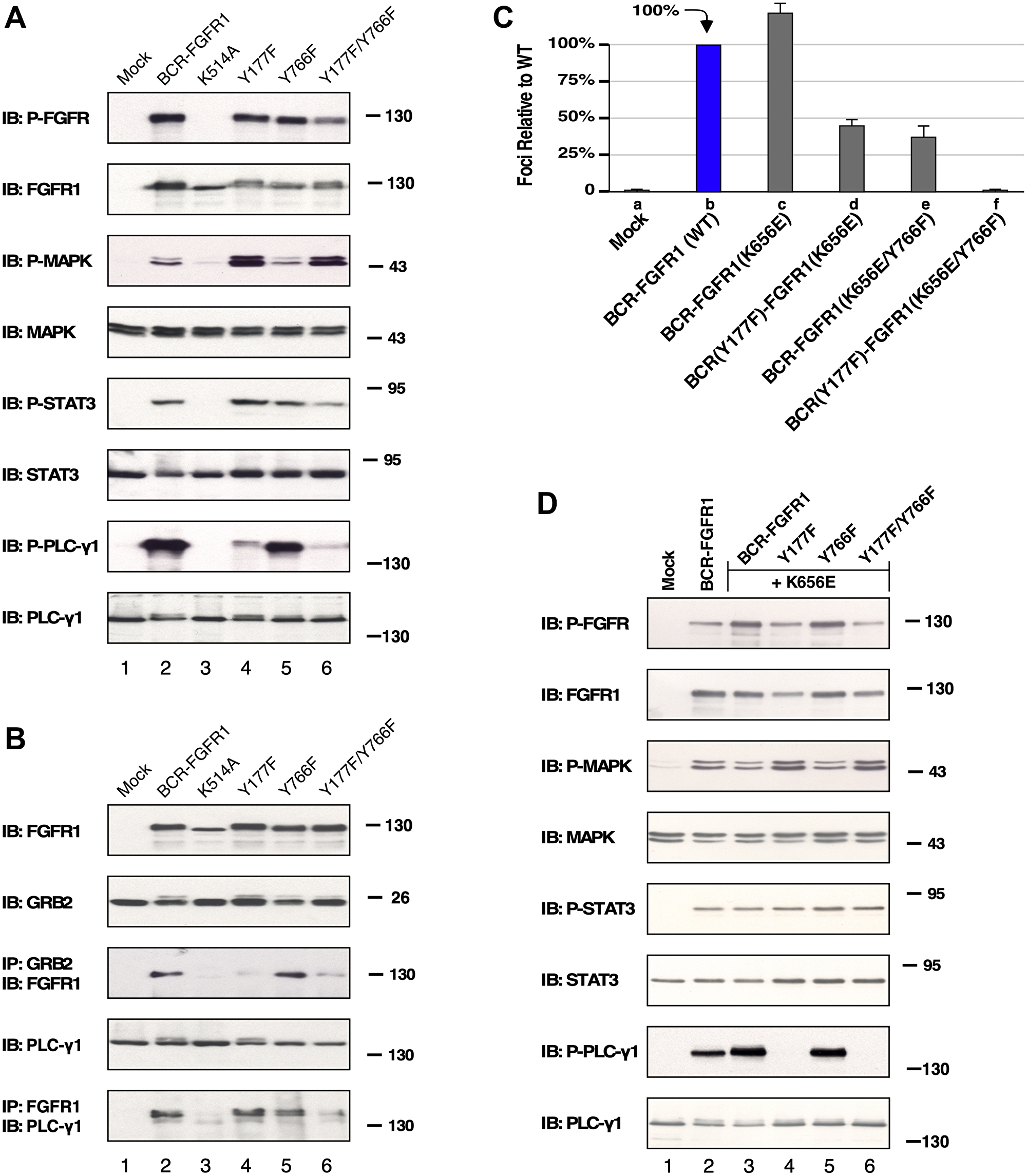 HEK293T cell lysate expressing BCR-FGFR1 or its derivatives subject to immunoblot analysis