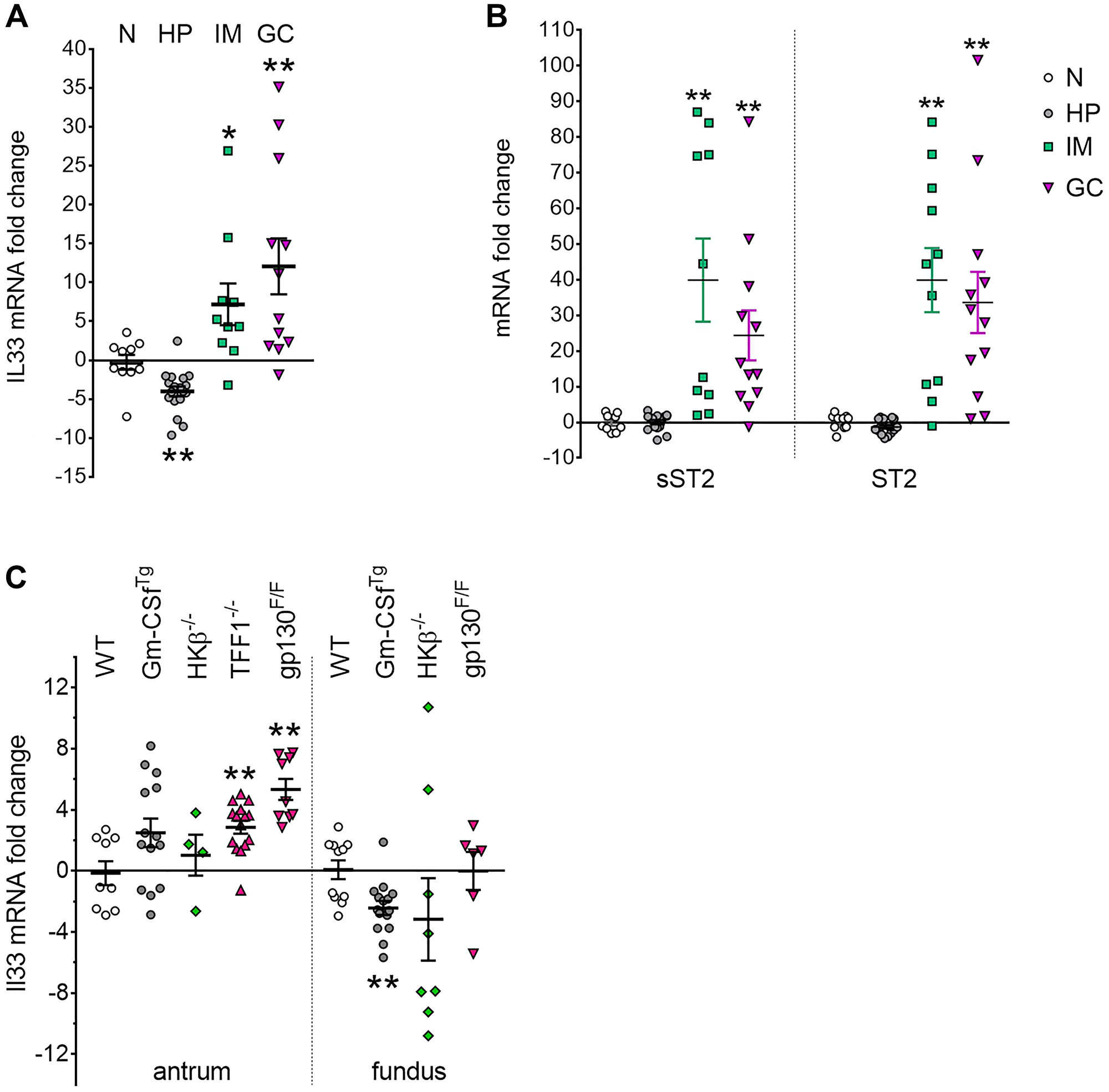 IL33 and ST2 overexpression in human and mouse gastric cancer