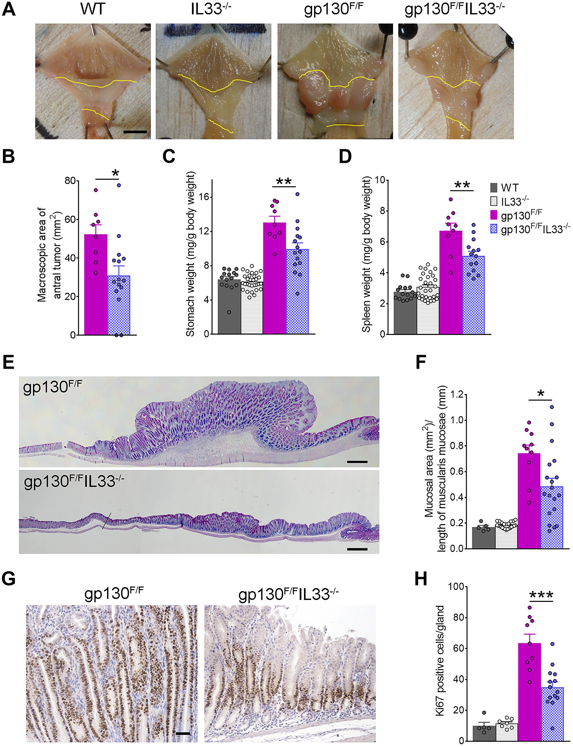 Gastric tumorigenesis in gp130F/F and gp130F/FIL33−/− mice