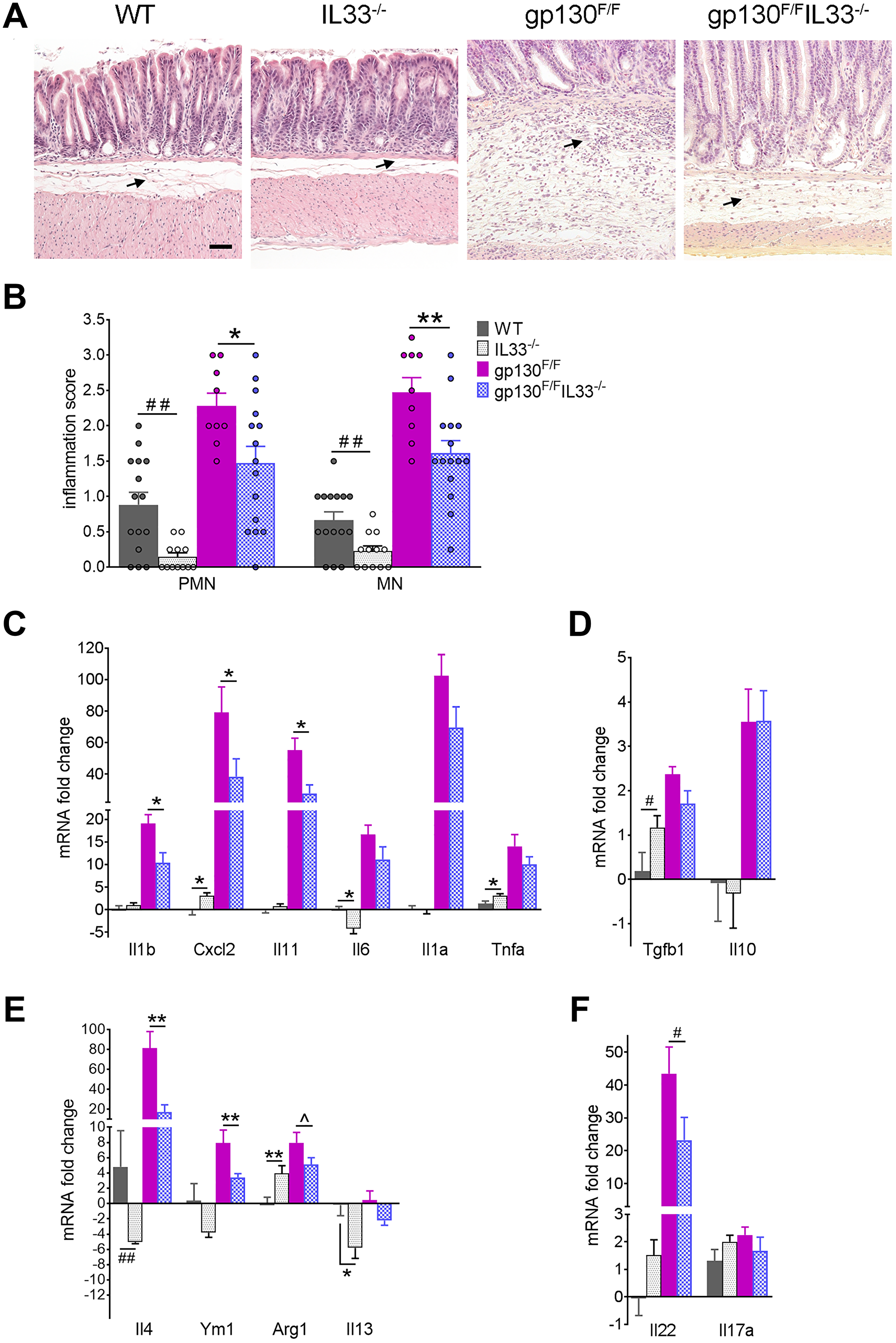 Gastric inflammation in gp130F/F and gp130F/FIL33−/− mice