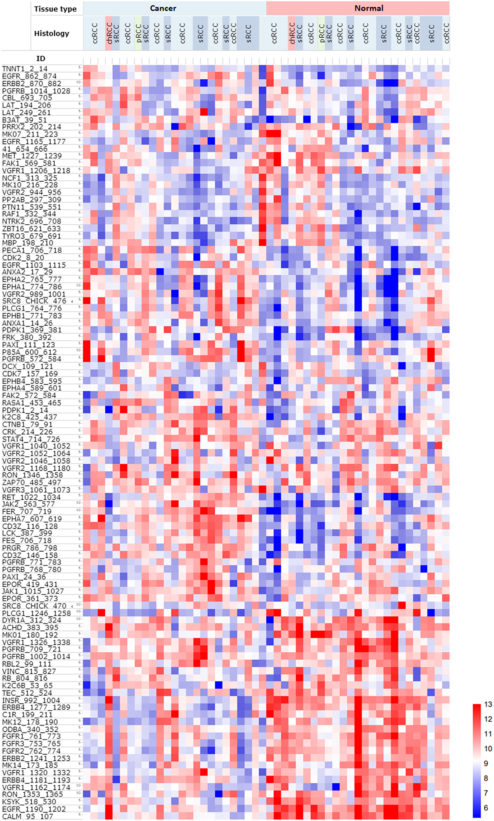 Heatmap of PTK phosphorylation profiles of 25 RCC patients, including malignant and matched normal tissue from the same patient (n = 50)