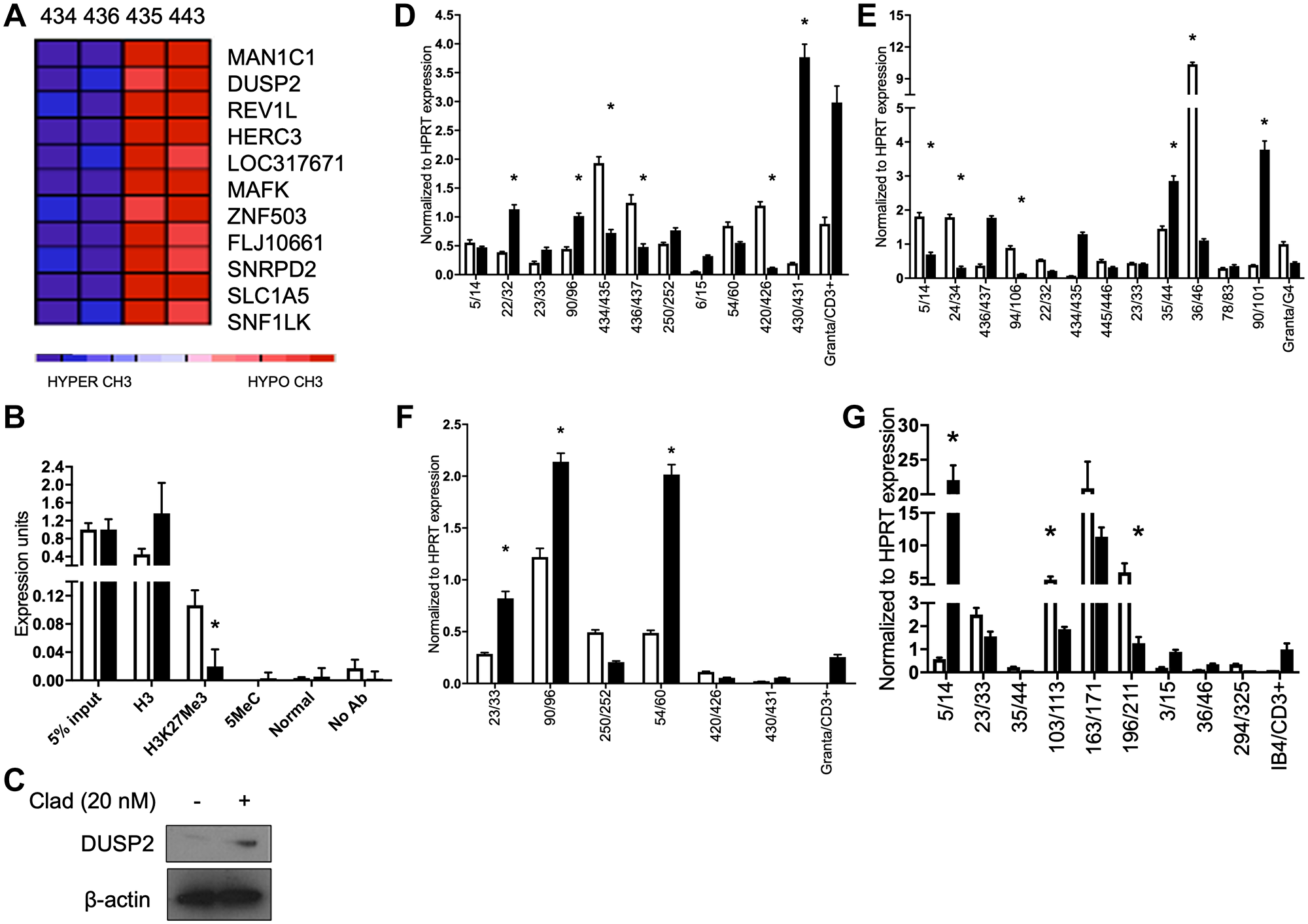 Cladribine derepresses the DUSP2 gene and affects DUSP1, TP53 and CEBPB expression