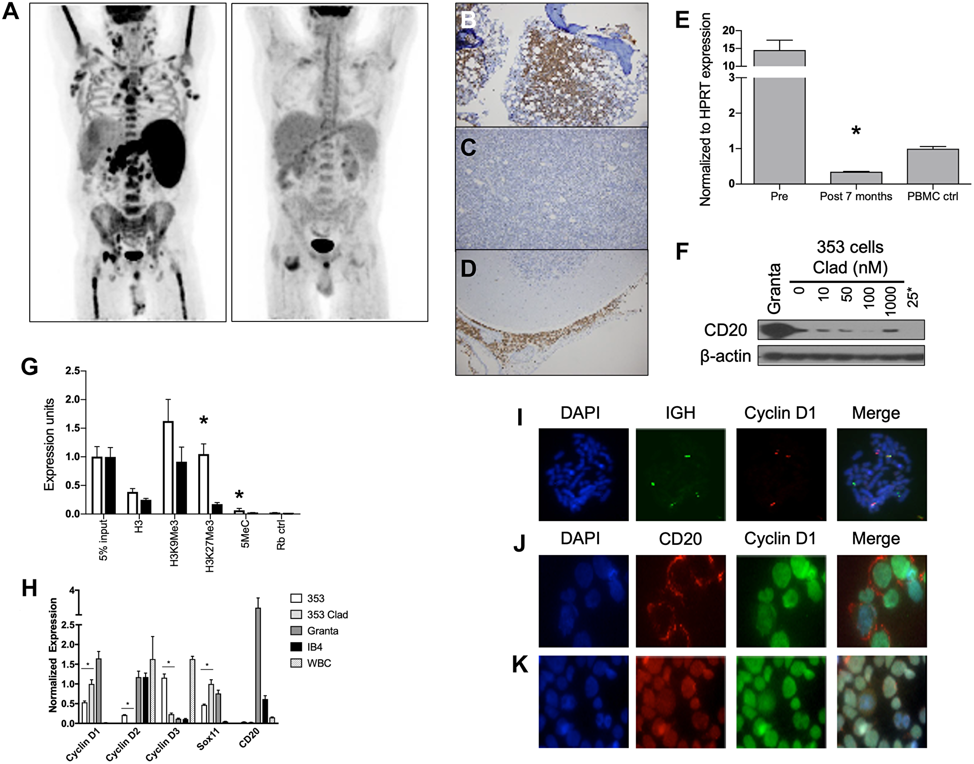 Mechanisms of SCR resistance and characterization of the CD20 negative MCL cell lines 353