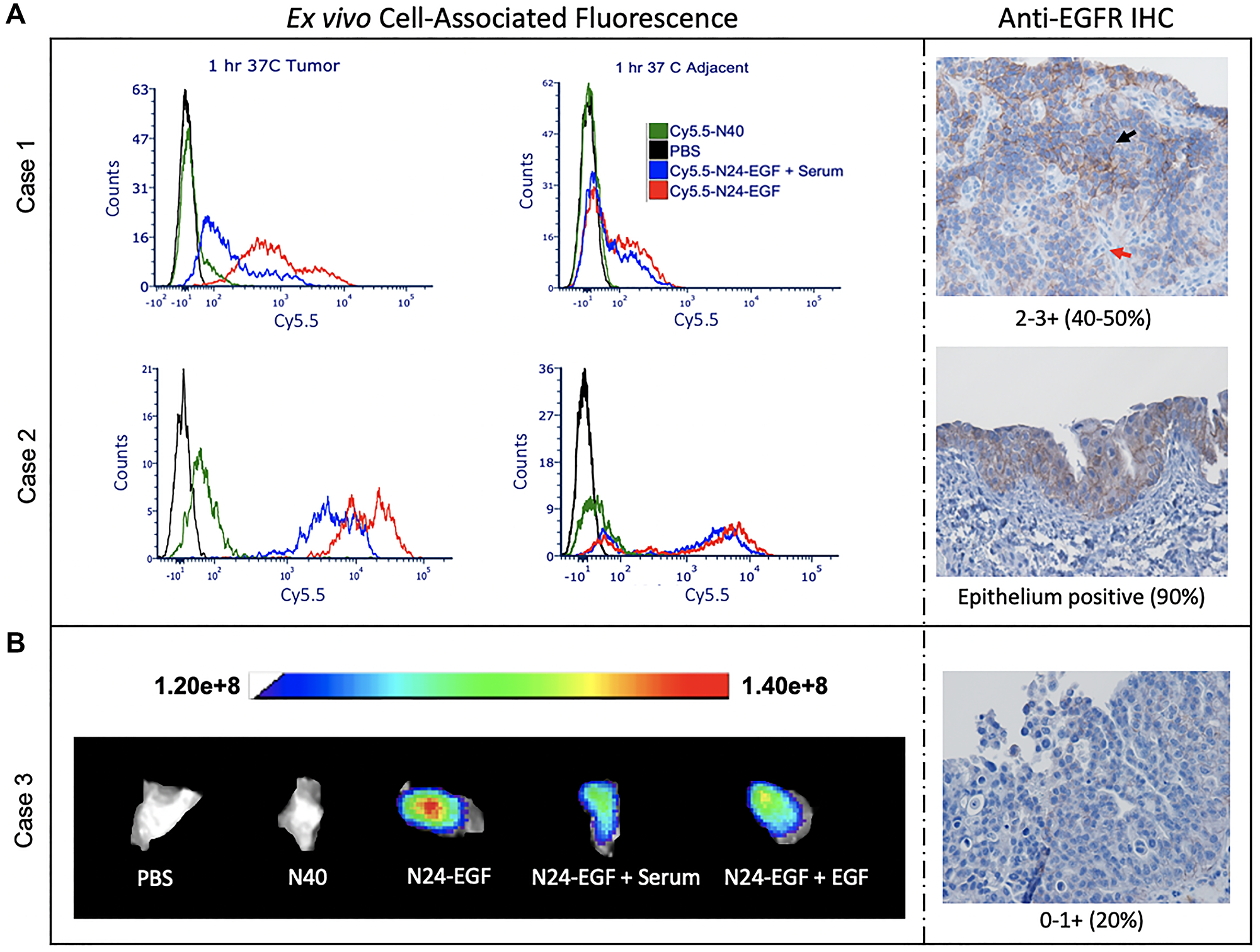 Ex vivo whole tissue imaging of canine bladder tumor tissue