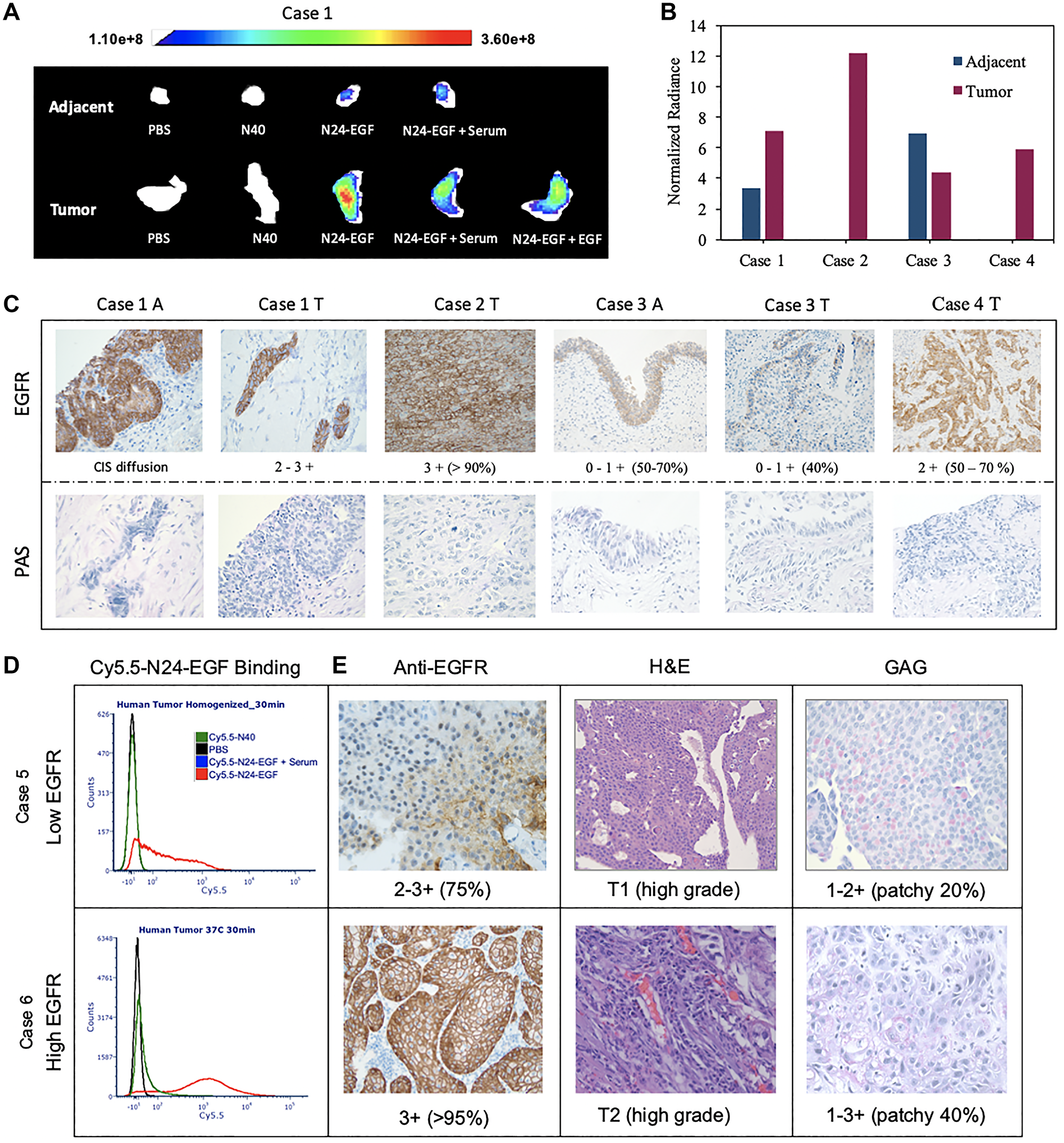 Ex vivo analysis of whole and homogenized human bladder tumor and adjacent tissue