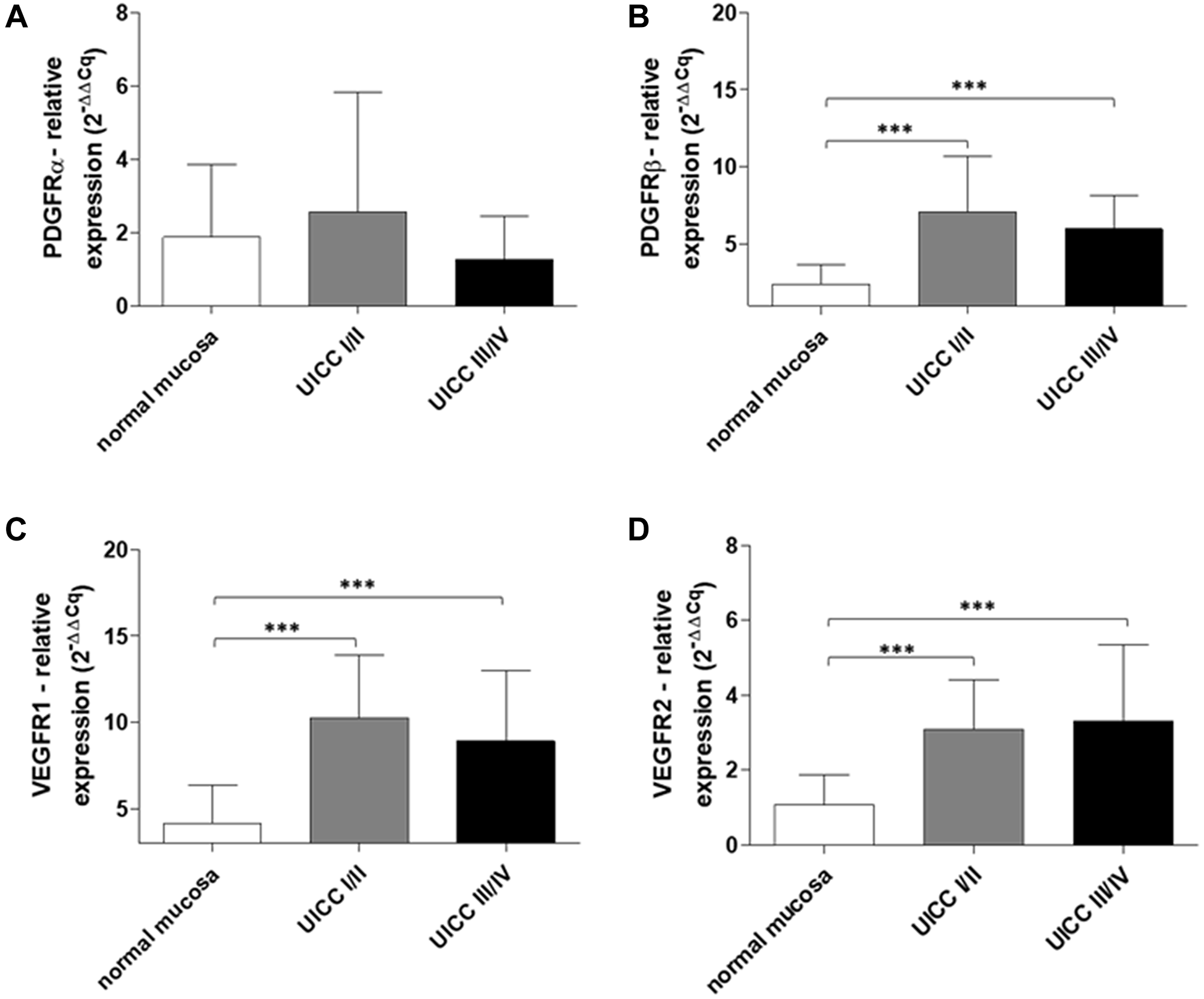 Increased PDGFR and VEGFR gene expression in early and advanced stage human colon cancer