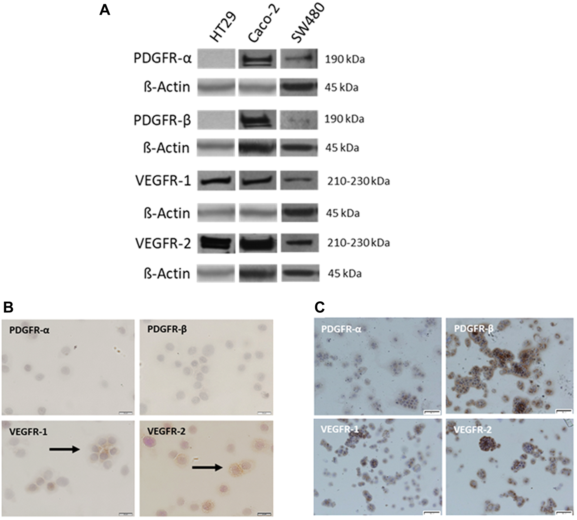 Variable expression of PDGFR and VEGFR in established CRC cell lines