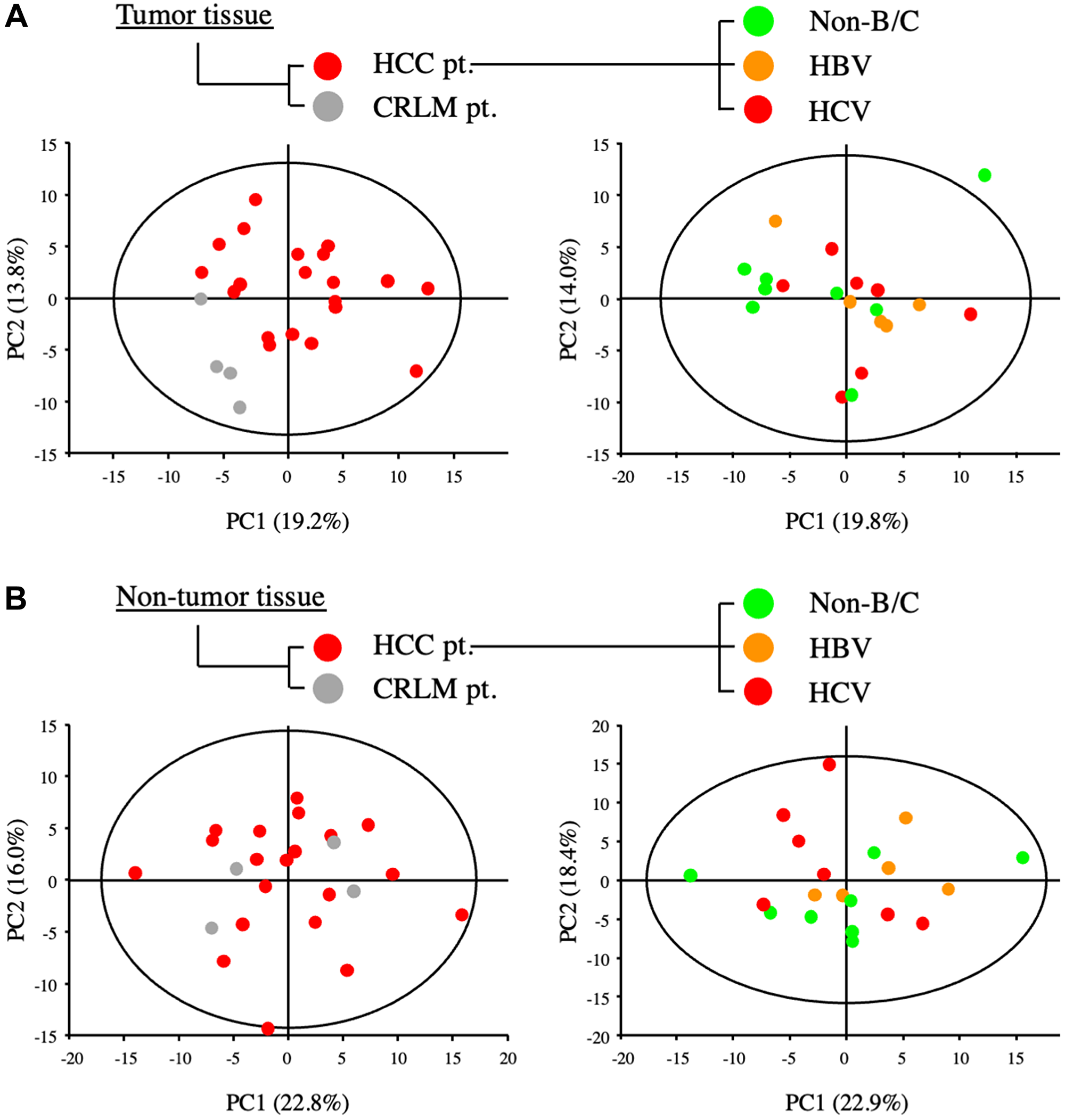 Metabolic analysis of primary and metastatic liver tumors from patients with HCC and colorectal cancer
