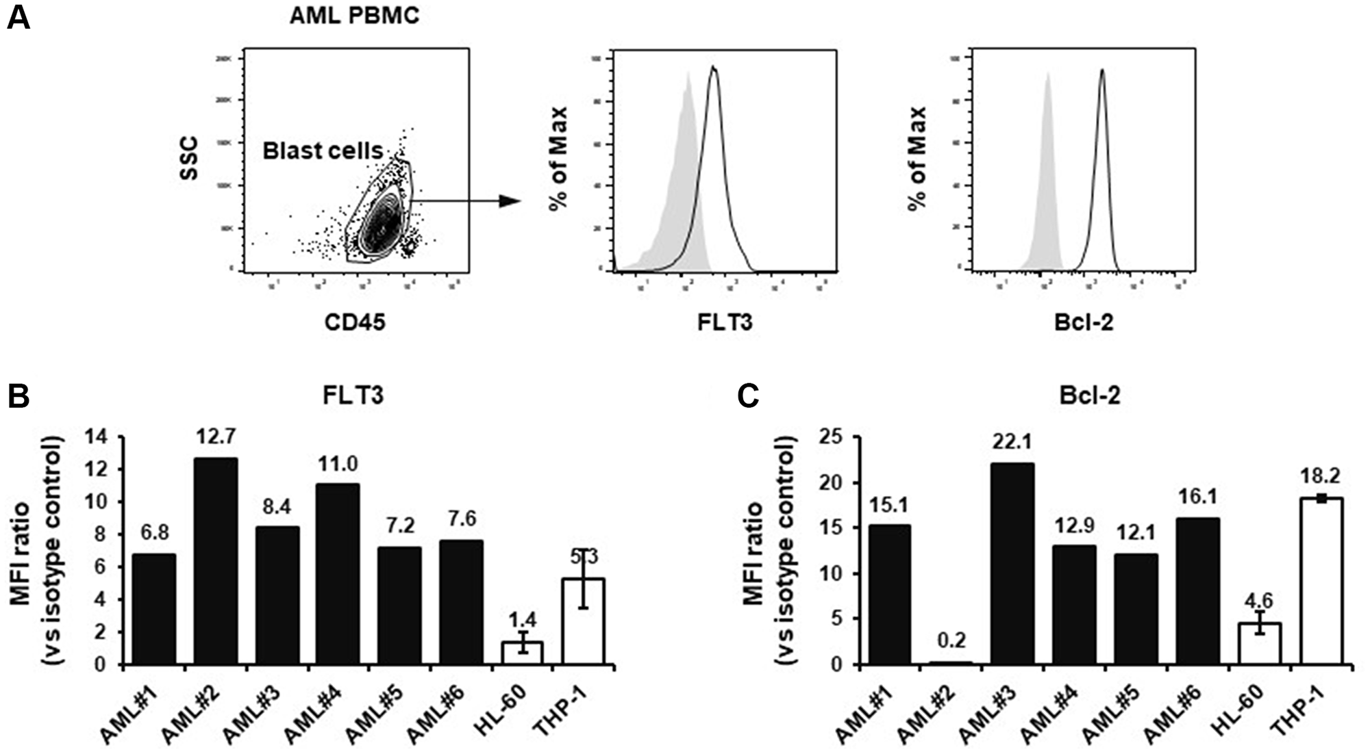 FLT3 and Bcl-2 expression in THP-1 cells and PBMCs from chemotherapy relapsed or refractory AML patients