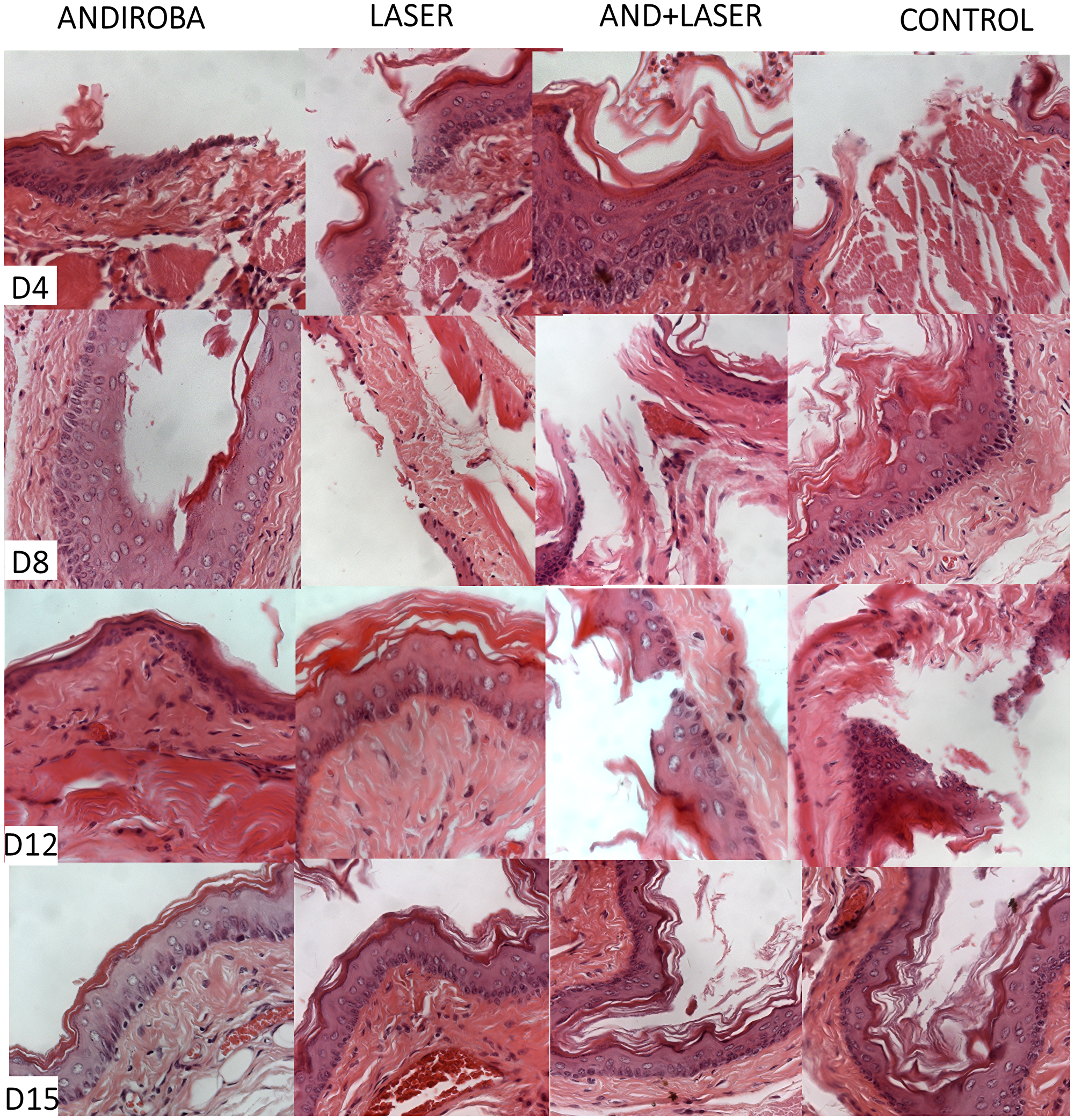 Histopathological evaluation of oral mucositis on days 4, 8, 12 and 15