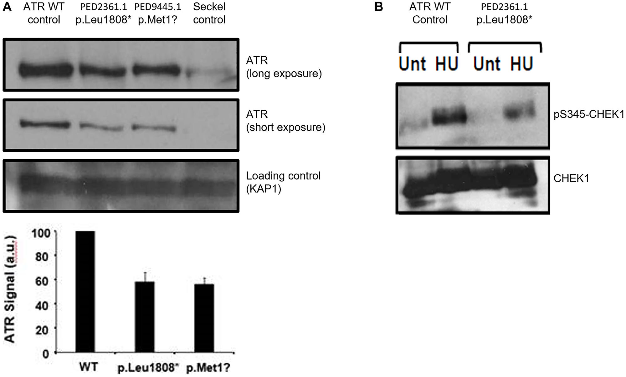 Impact of mutations on ATR expression and intra S phase checkpoint