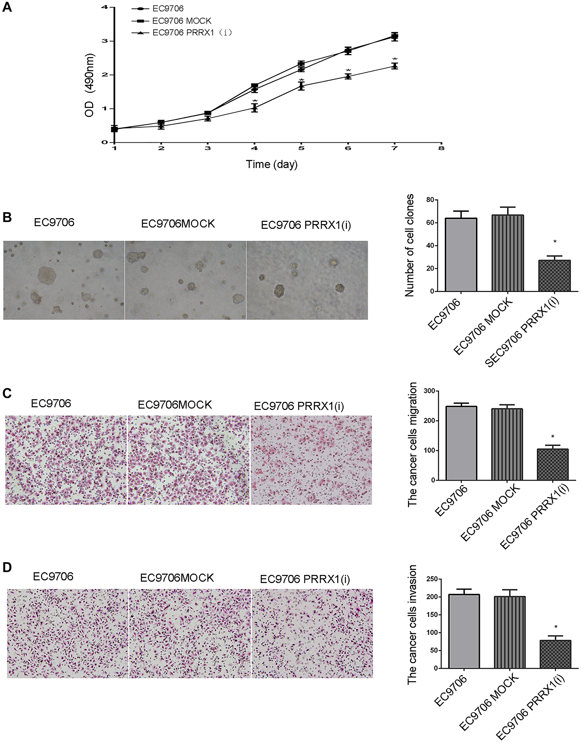 PRRX1 modulates proliferation, colony formation, migration and invasion in oesophageal cancer cells