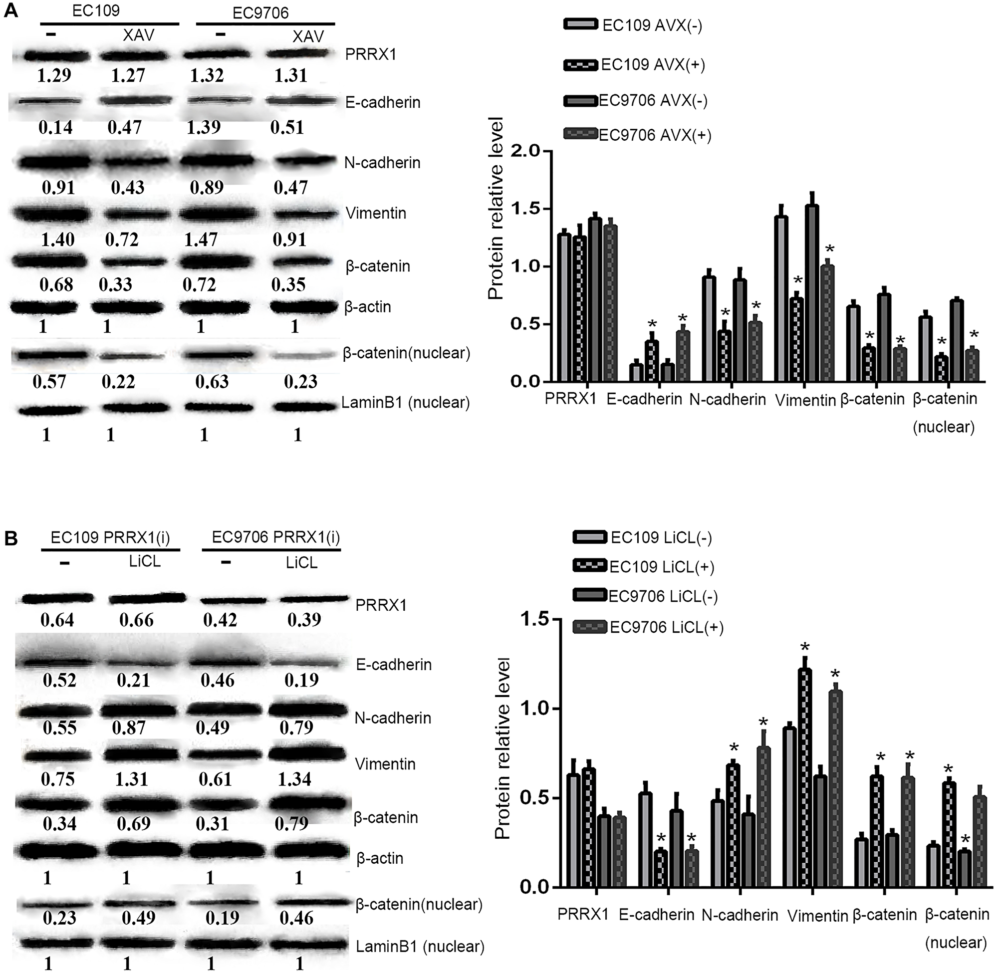 PRRX1 regulates EMT via the WNT/β-catenin pathway