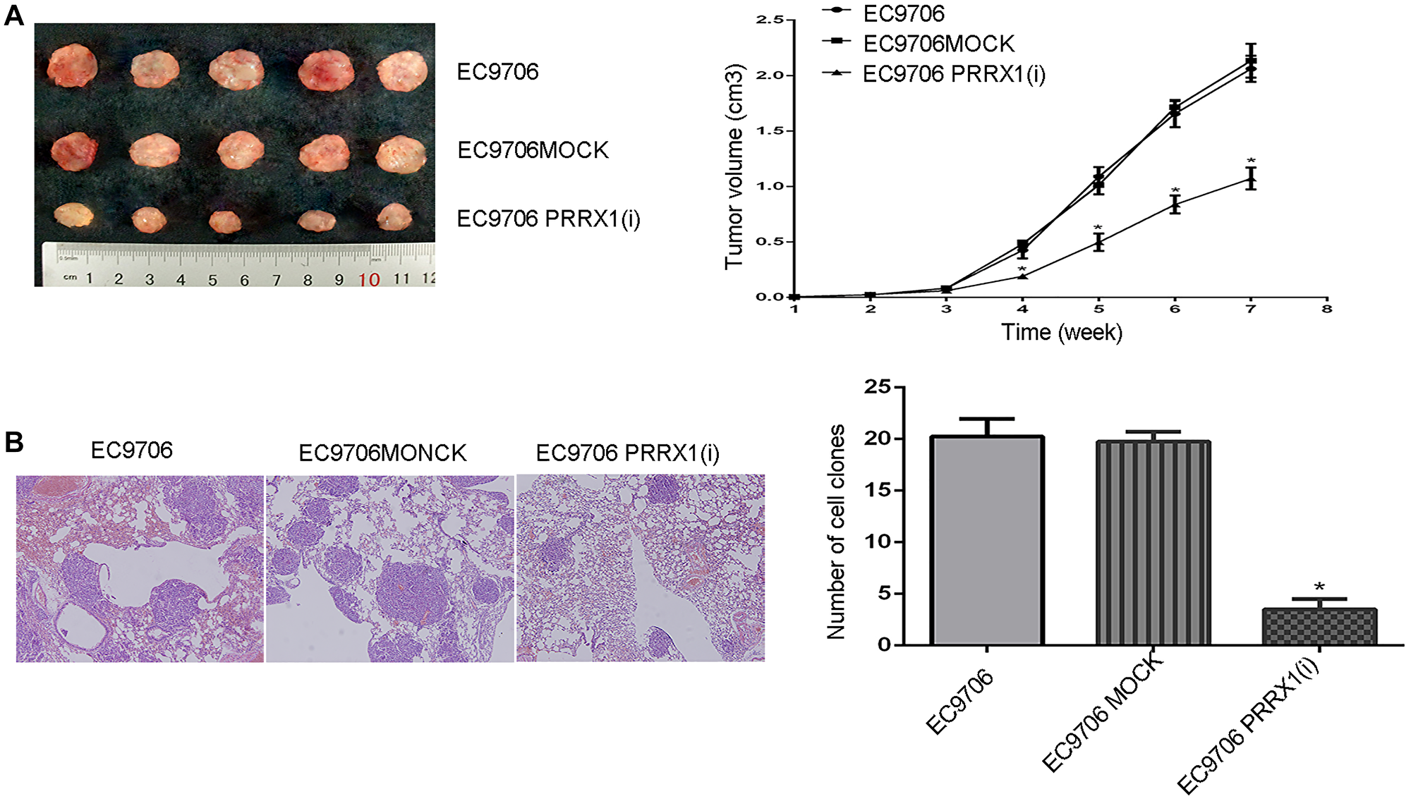PRRX1 downregulation inhibits cell proliferation and lung metastasis in vivo