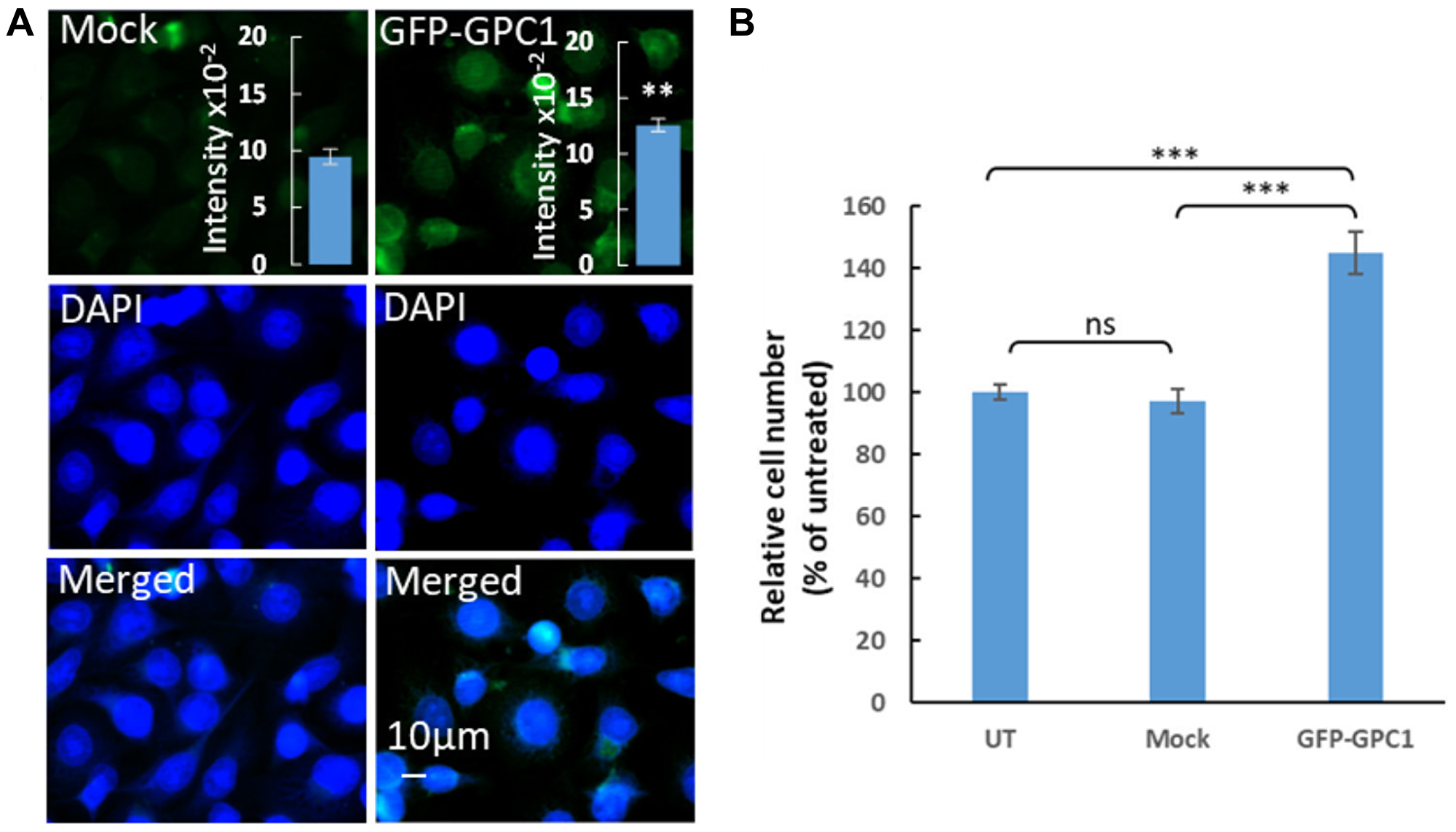 Overexpression of GPC1 increases proliferation of T24 cells
