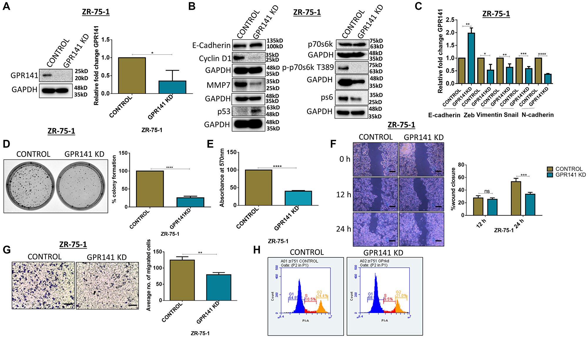 GPR141 silencing suppresses migration of breast cancer cells and tumorigenesis in vitro