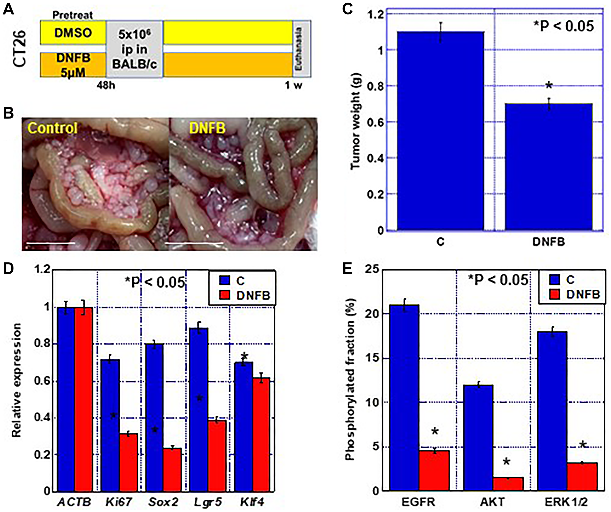 Effect of creatine shuttle inhibition by DNFB on peritoneal dissemination of CT26 cells
