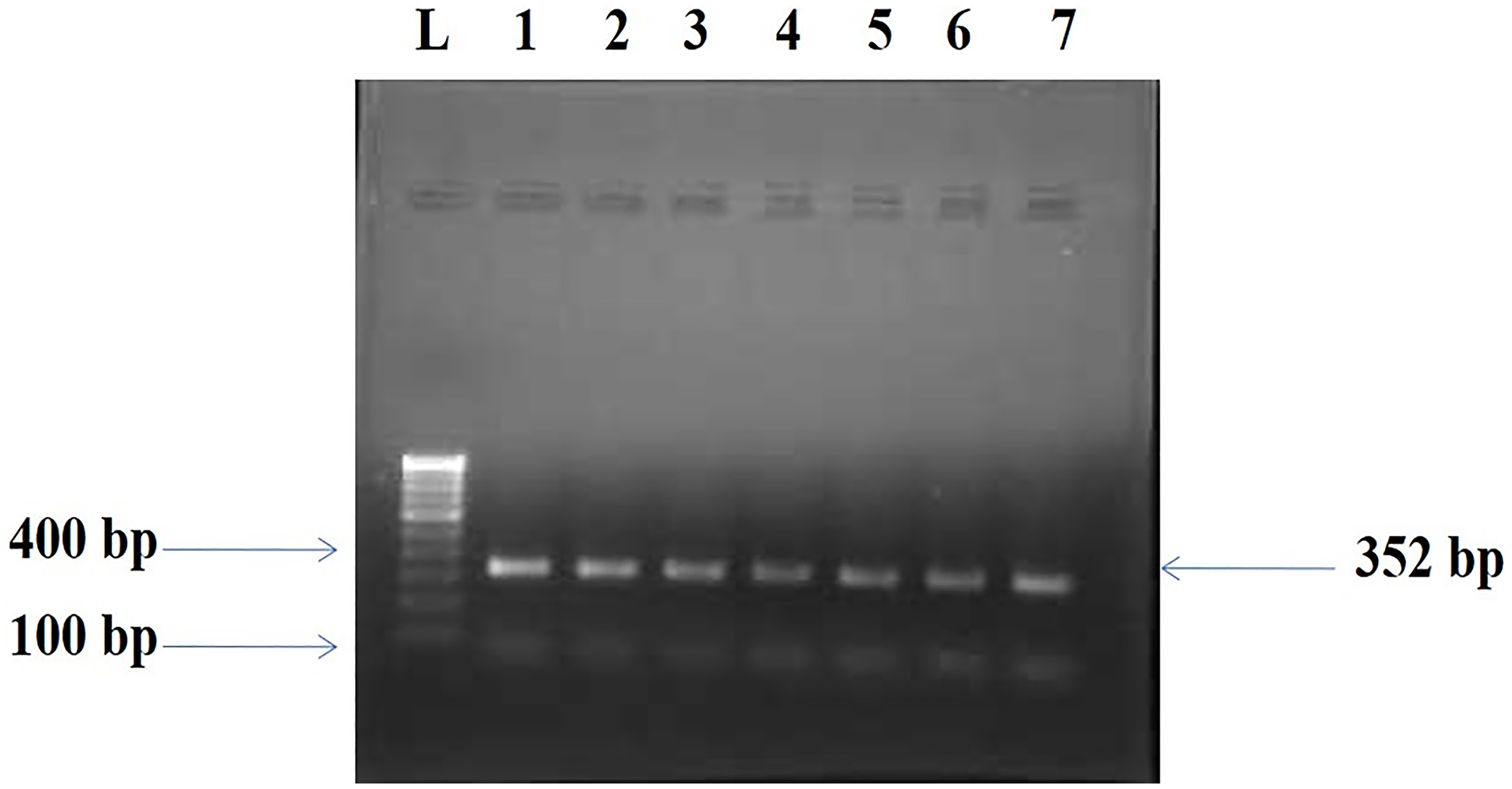 Amplified PCR product 352 bp of BORIS gene