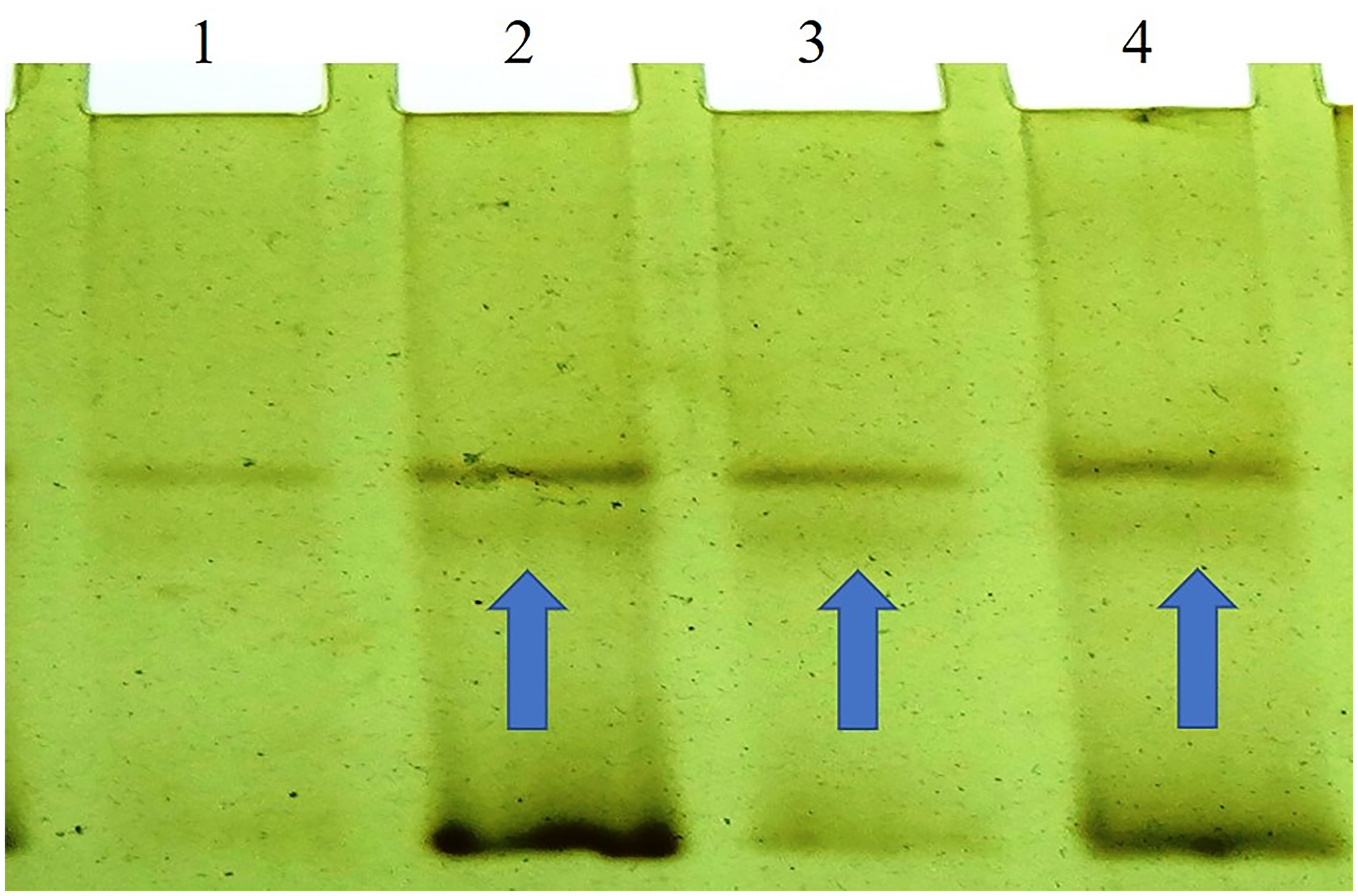 SSCP (non-radio-active) analysis of the BORIS gene which shows a variation or shifts in the band at Lane 2, 3, and 4 of the breast tumor samples