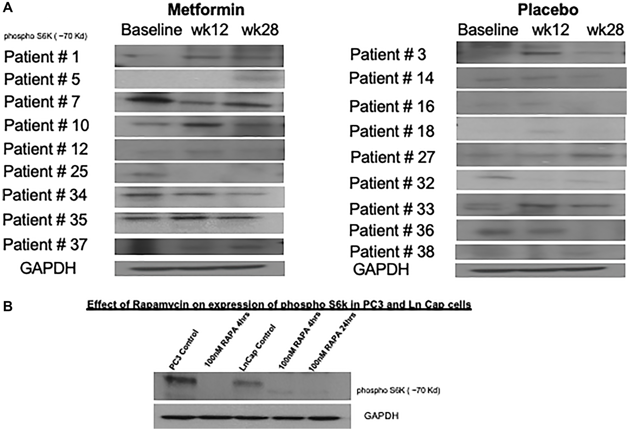 Variable changes in phosphorylation of S6 kinase 1 was observed in both cohorts