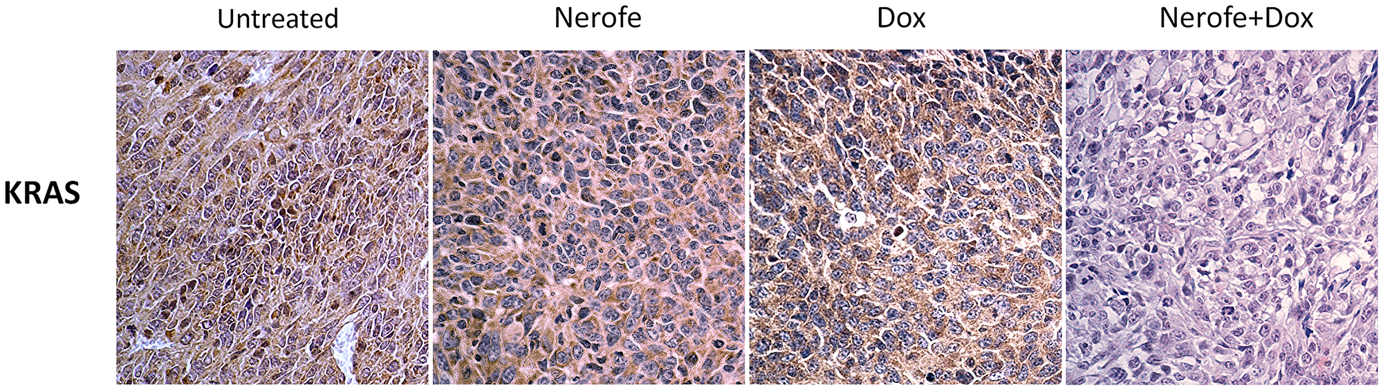 IHC analysis of murine model CT26 tumors using KRAS antibody