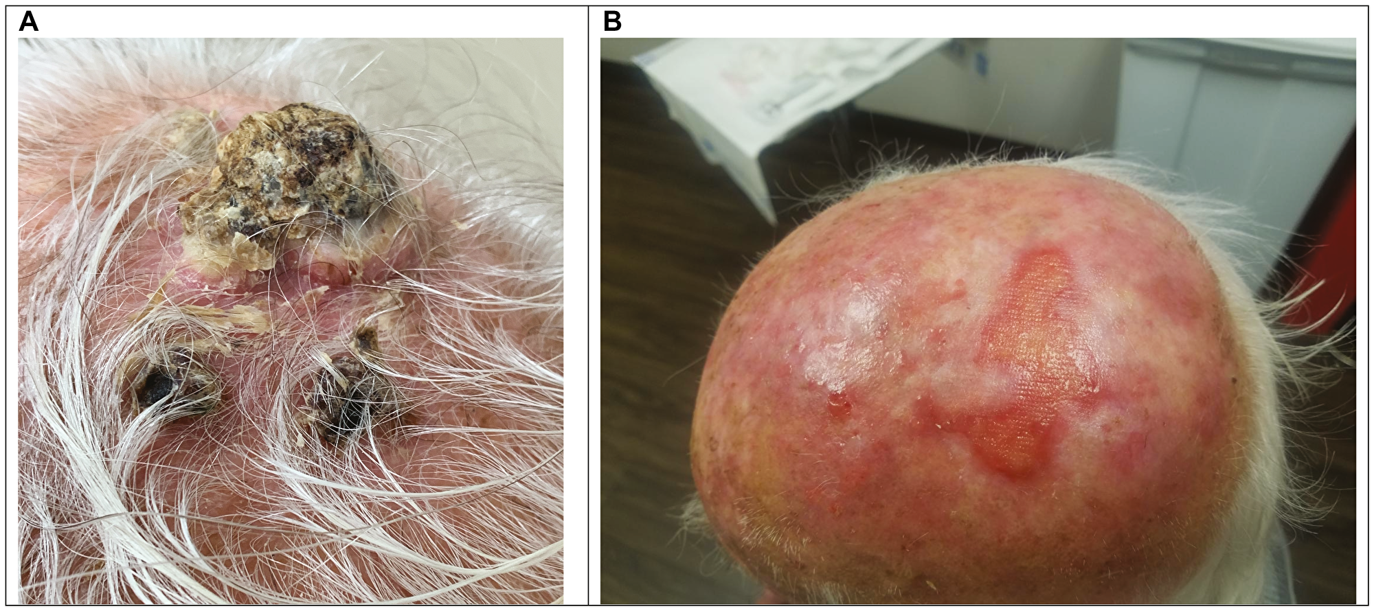Example of treatment response
