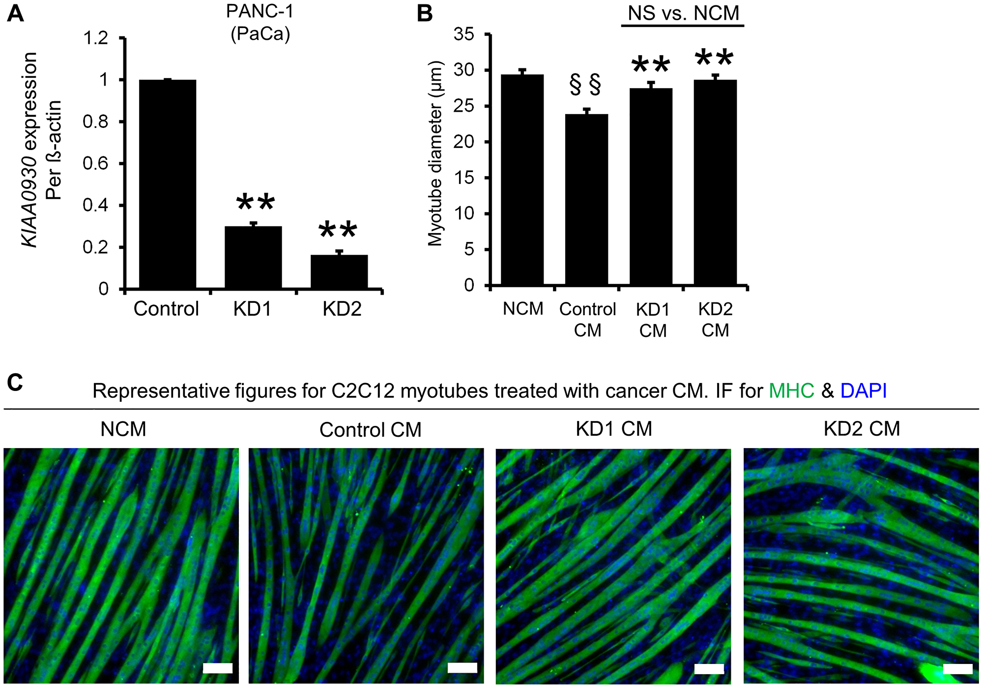 ShRNAs targeting KIAA0930 decrease KIAA0930 mRNA expression and suppress muscle atrophy in PANC-1 cells in vitro