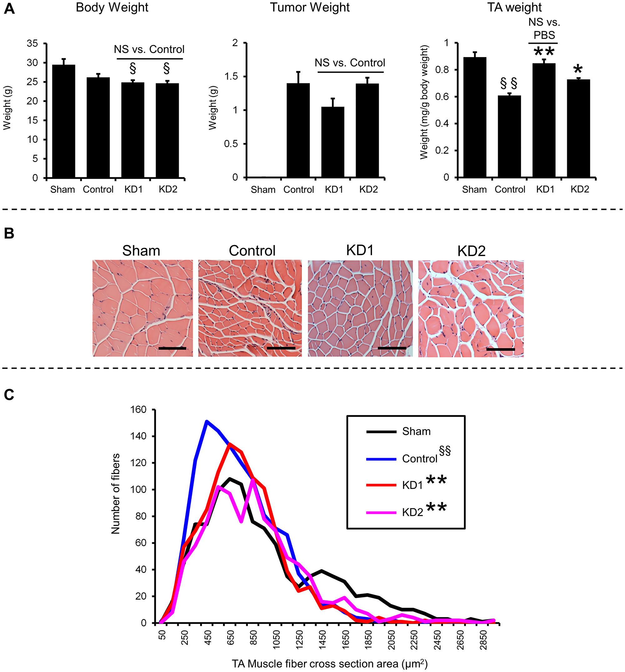 KIAA0930 knockdown alleviates muscle atrophy in a PANC-1 orthotopic xenograft model
