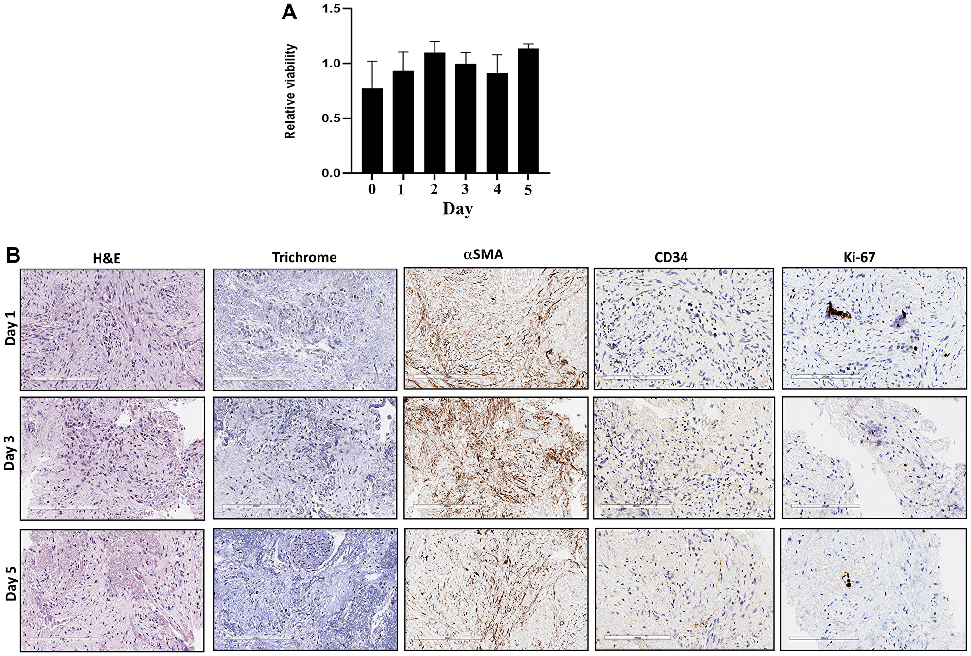 (A) Sliced fresh tumor samples were cultured in 96-well plates and viability was measured with PrestoBlue daily for 5 days. X-axis is days, and Y-axis is proportion of viability. (B) Sliced fresh tumor samples were embedded with paraffin, and tissue sections were stained with hematoxylin and eosin (H$!--ESC