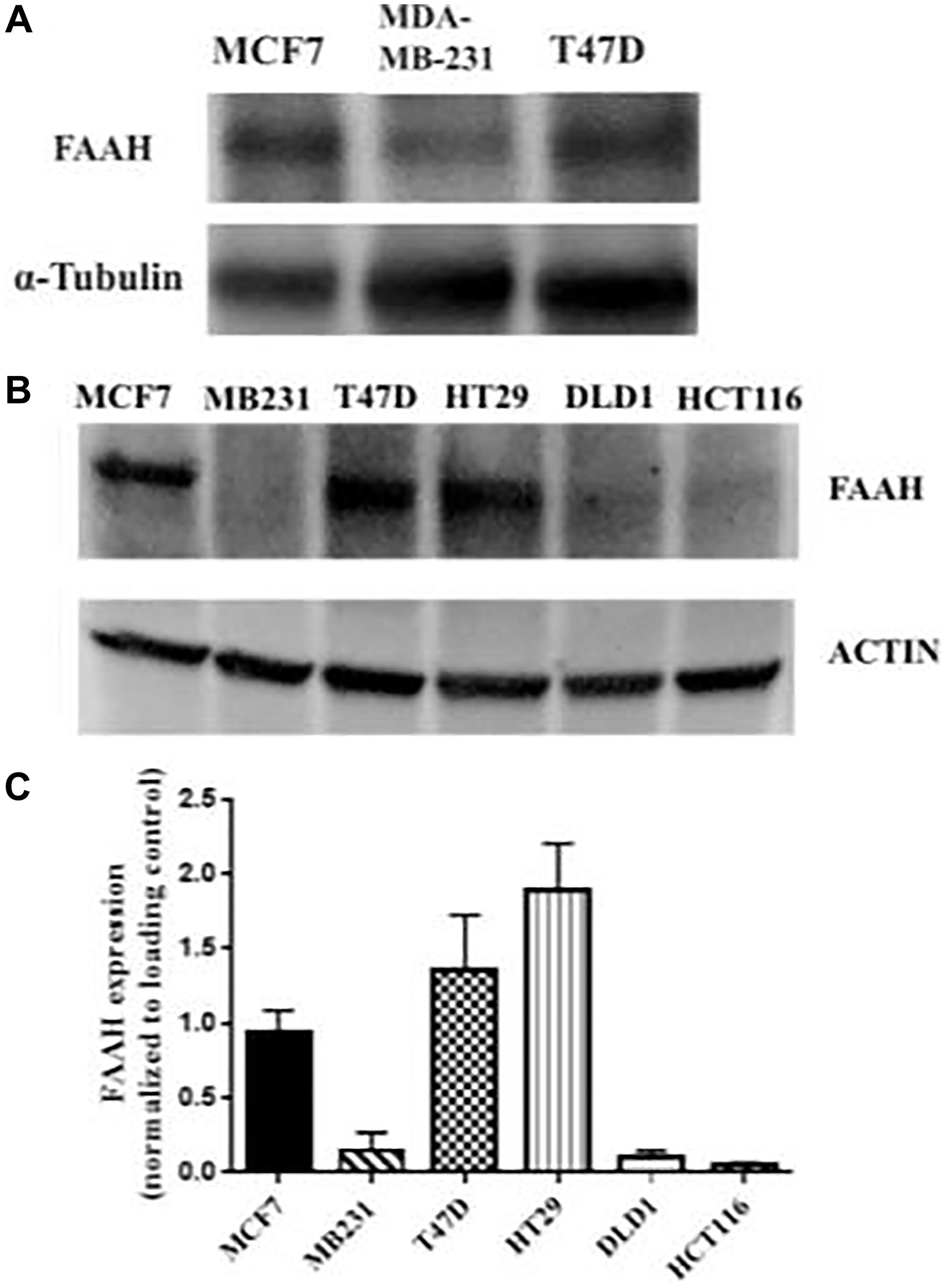 FAAH expression profiles in breast cancer and control cell lines