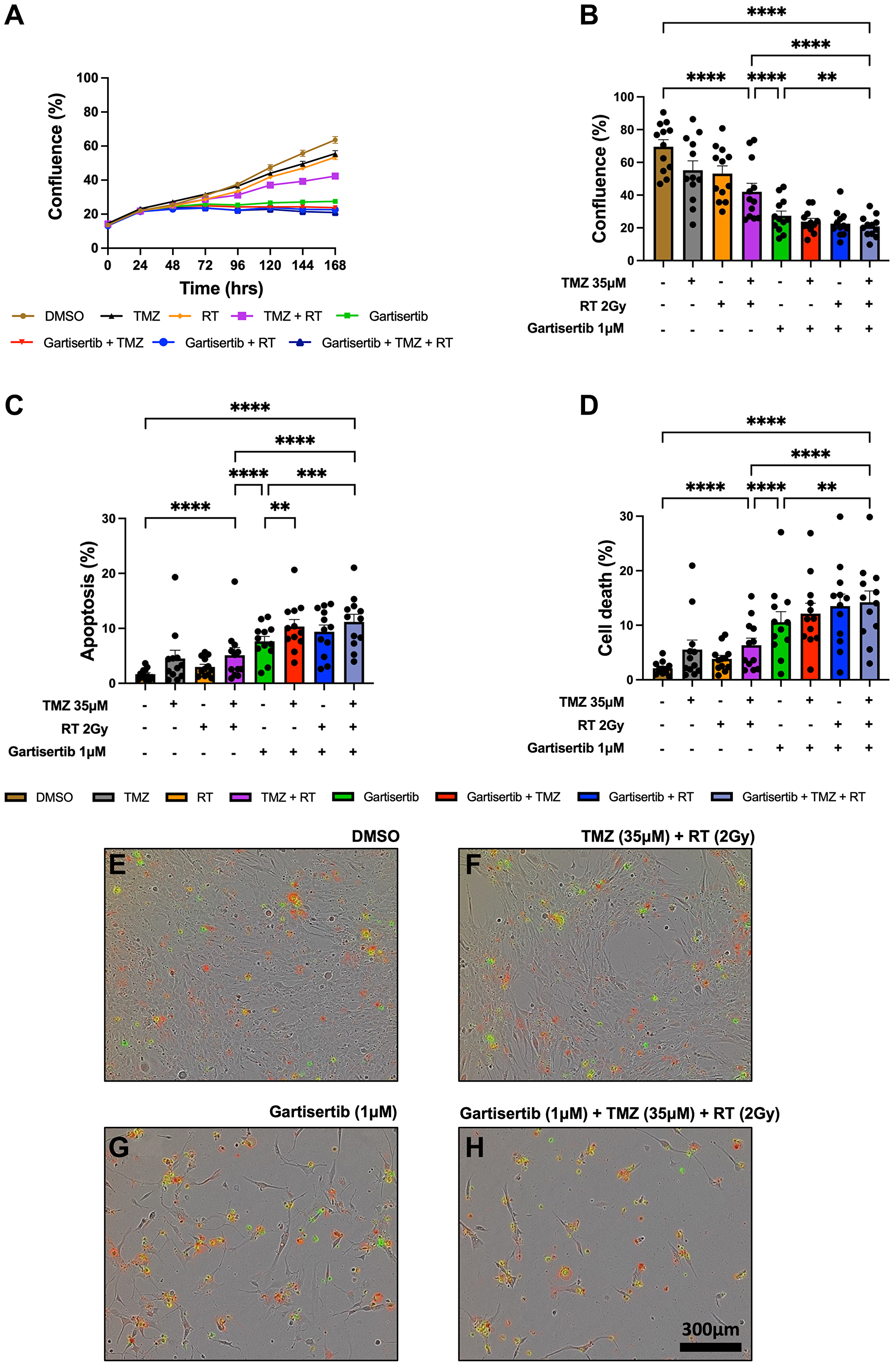Live-cell imaging of glioblastoma cell lines treated with gartisertib (1 μM) and/or TMZ (35 μM) and/or RT (2 Gy)