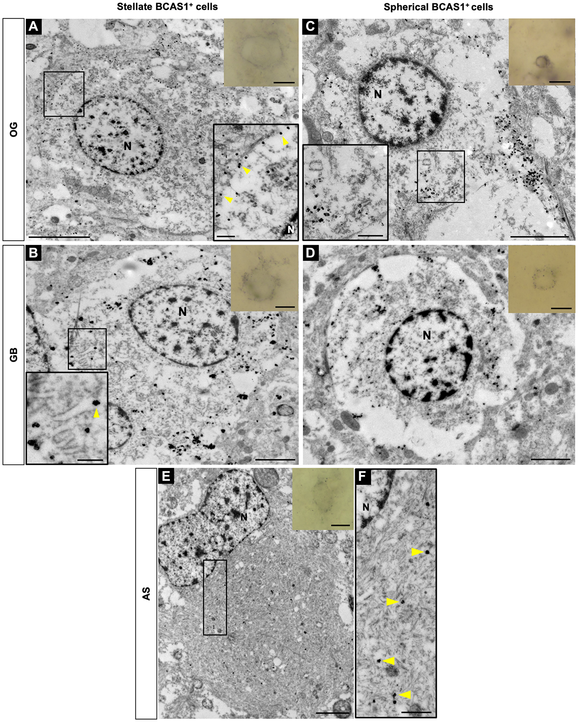 Subcellular localization of BCAS1 protein and ultrastructural features of BCAS1+ cells
