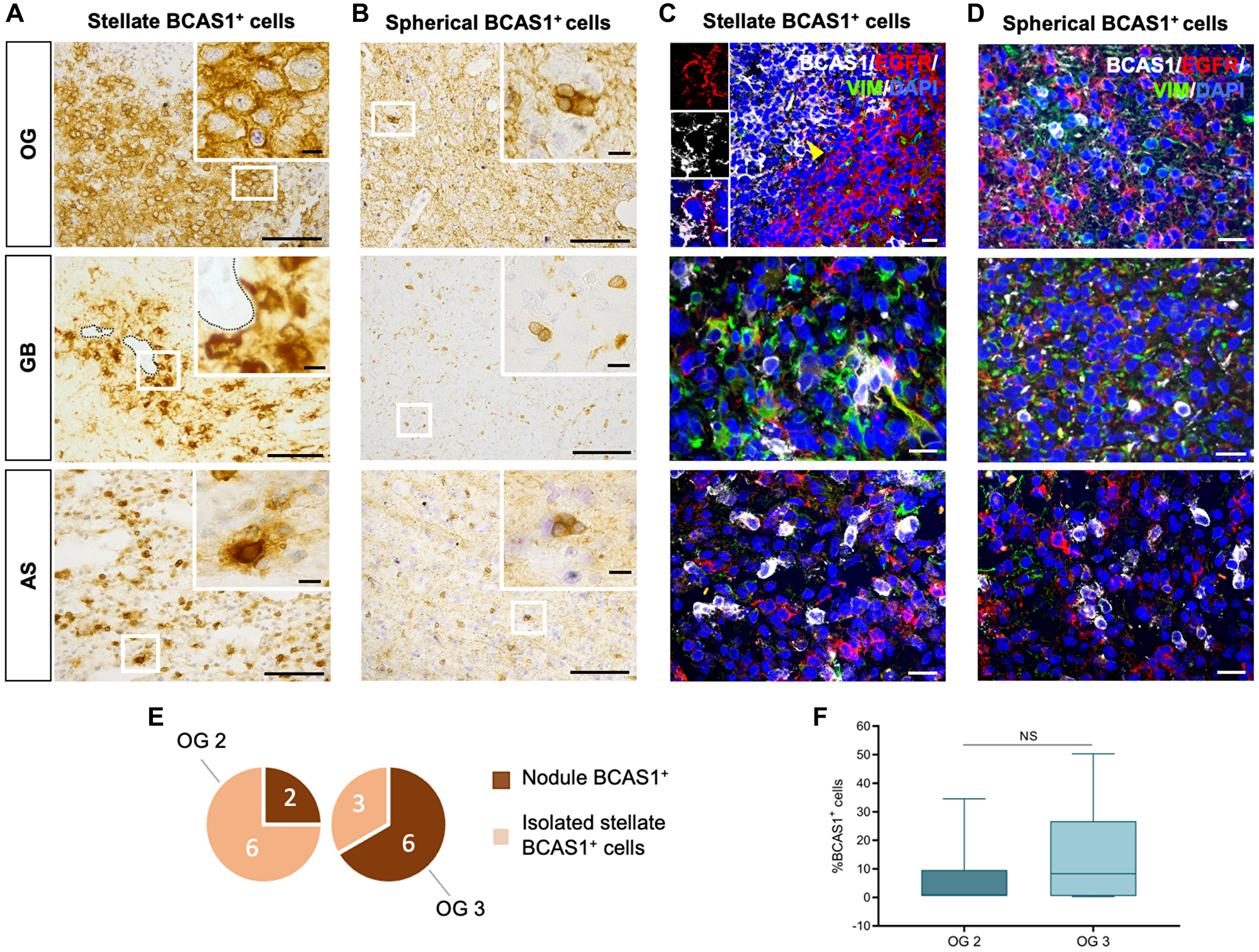 BCAS1+ cells in OG form nodules that are surrounded by EGFR+ cells