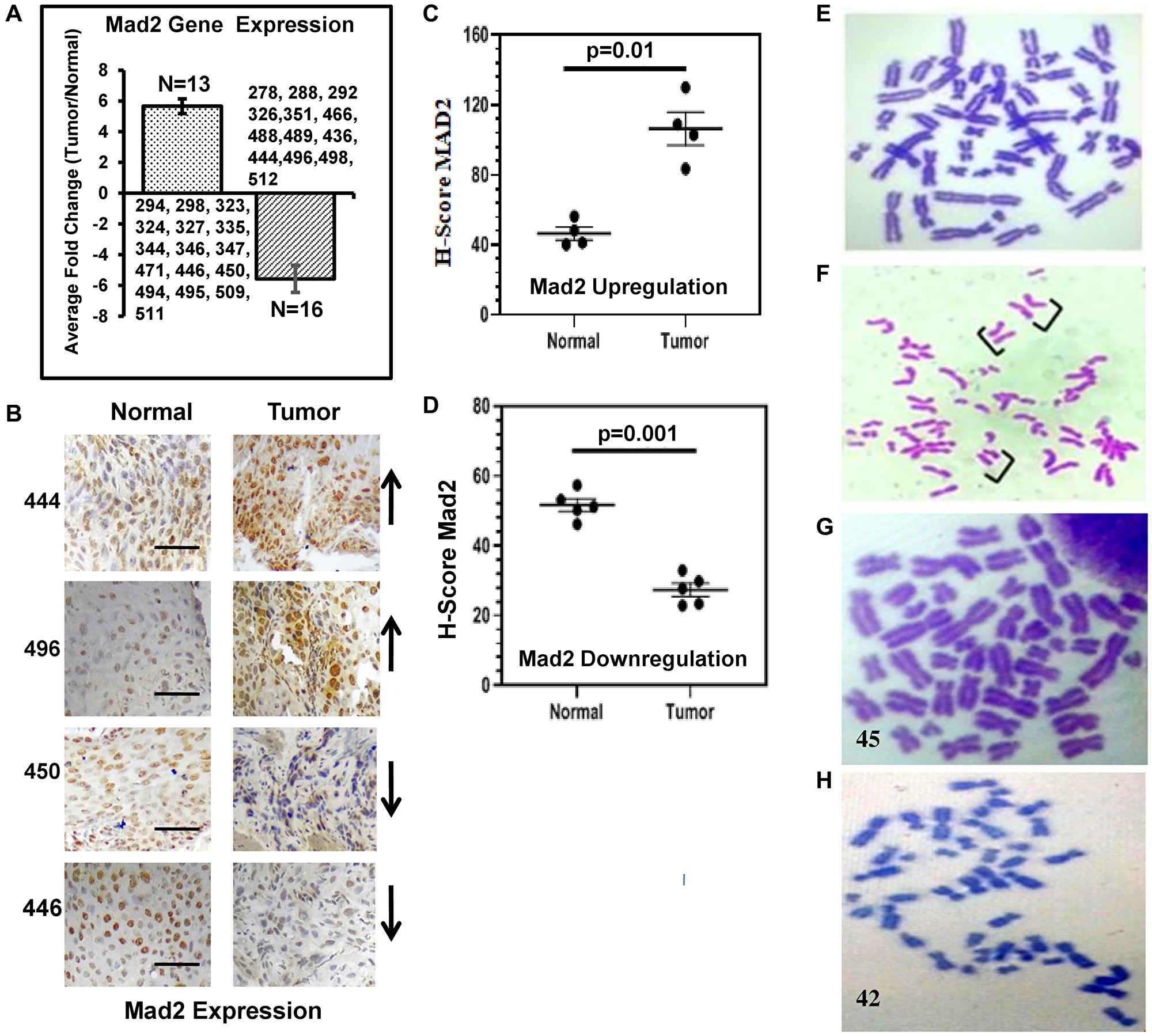 Expression analysis of the human Mad2 gene and karyotype analysis of genomic instability in esophageal cancer patients