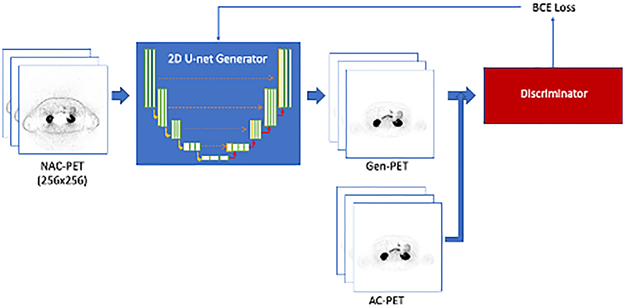 Training workflow for the Pix-2-Pix GAN model
