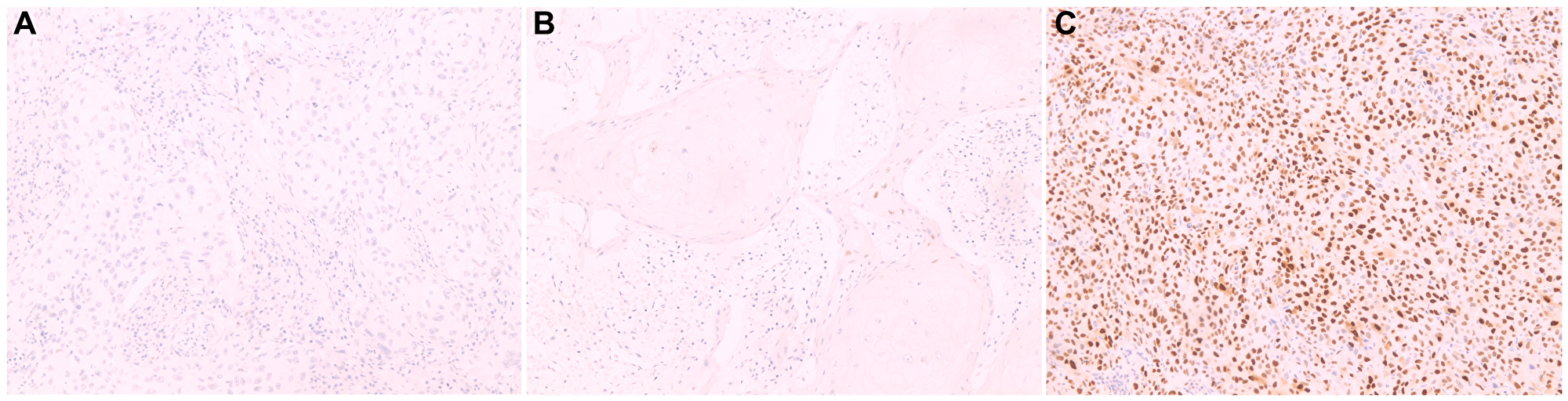Cyclin D1 protein expression by immunohistochemistry in histological sections