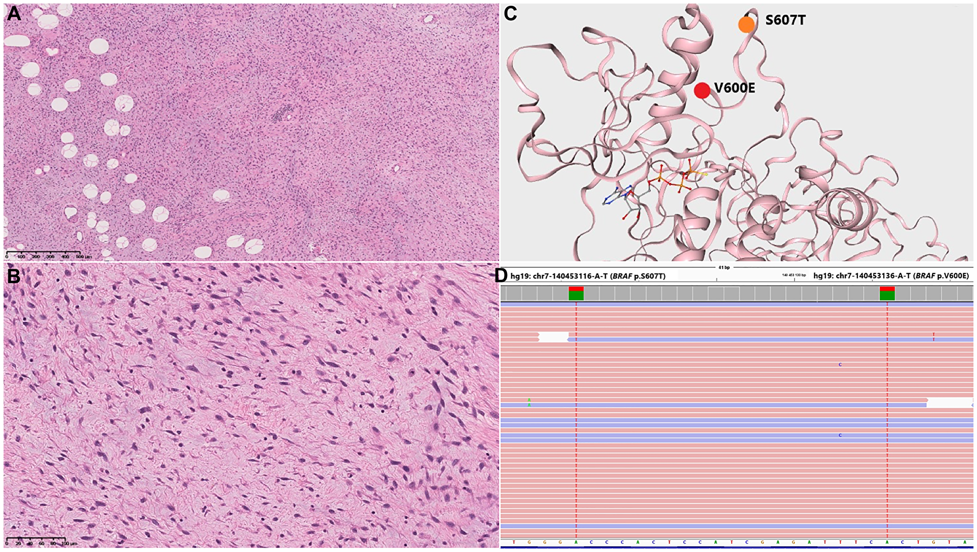 Morphological and genetic findings