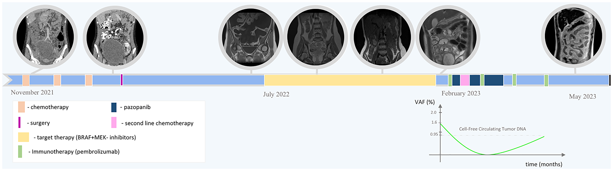 Overall treatment/monitoring timeline with a plot showing the circulating cell-free tumor DNA dynamics during immunotherapy