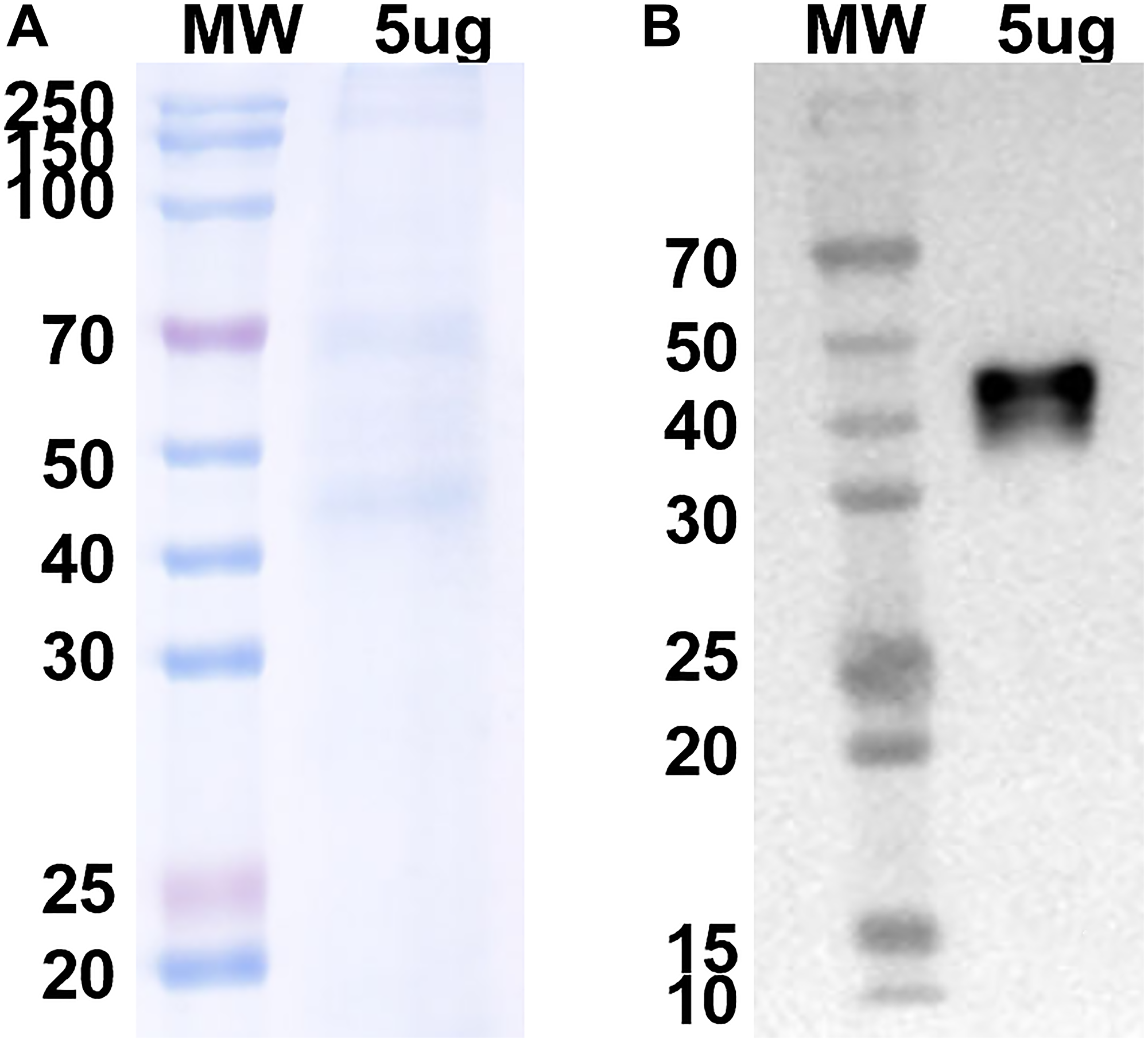 Coomassie blue stained gel and Western blot analysis using anti-His antibody of purified His-tagged anti-V-ATPase nanobody