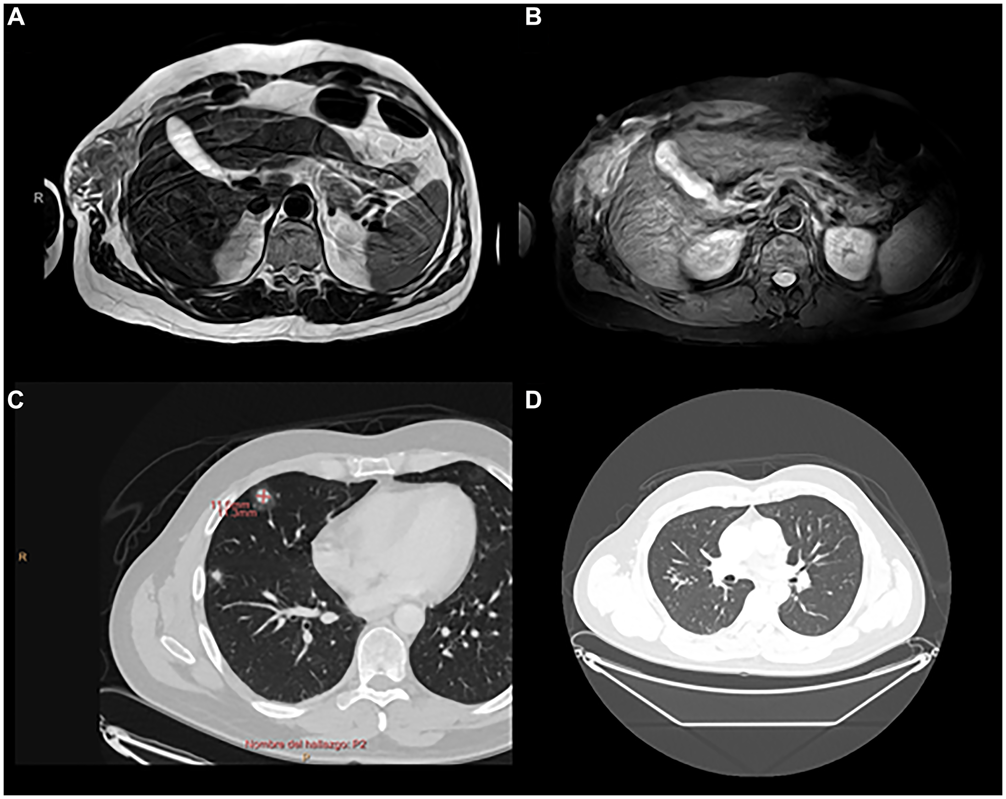 Radiological imaging before treatment