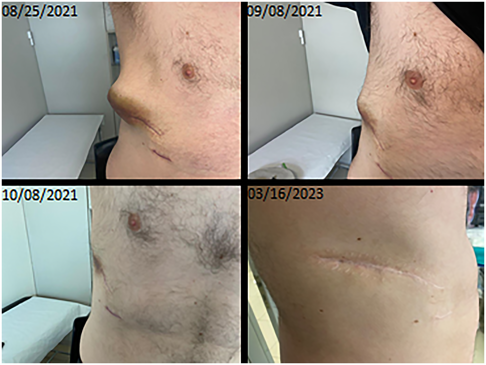 Clinical evolution of the lesion after initiation of targeted treatment