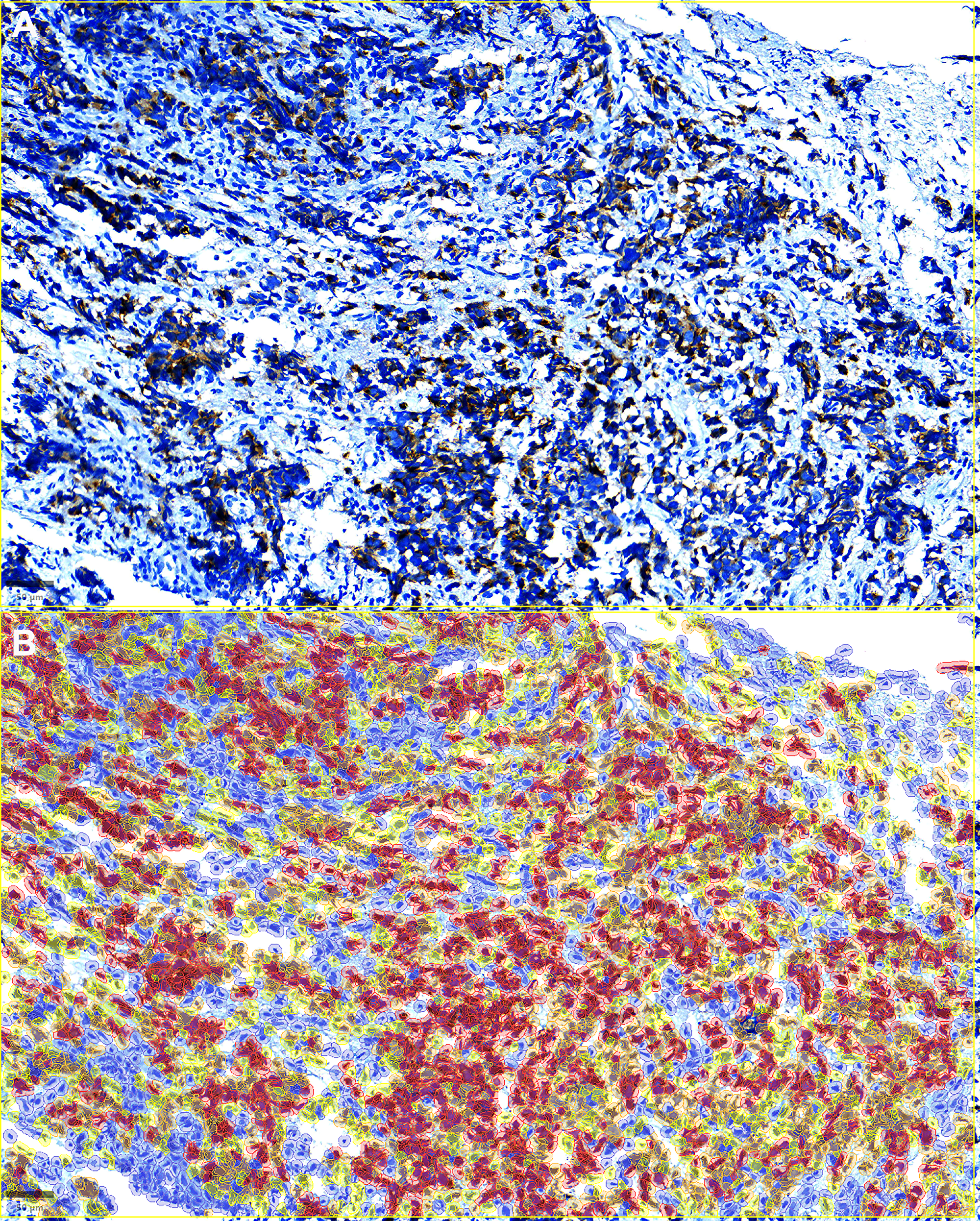 Qupath H-score calculation and analyses