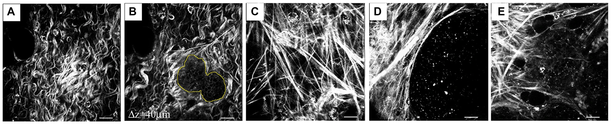 Representation of common TACS in mouse mammary tissue