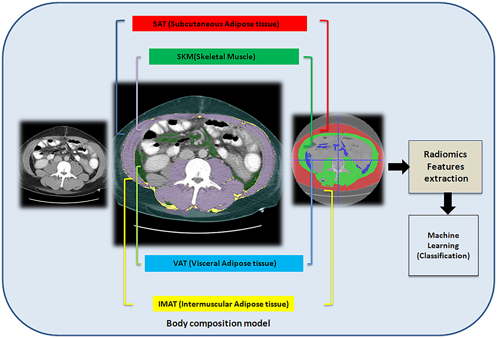 Workflow of the prediction of primary sclerosis cholangitis using computed tomography-based radiomics signature and the body composition model