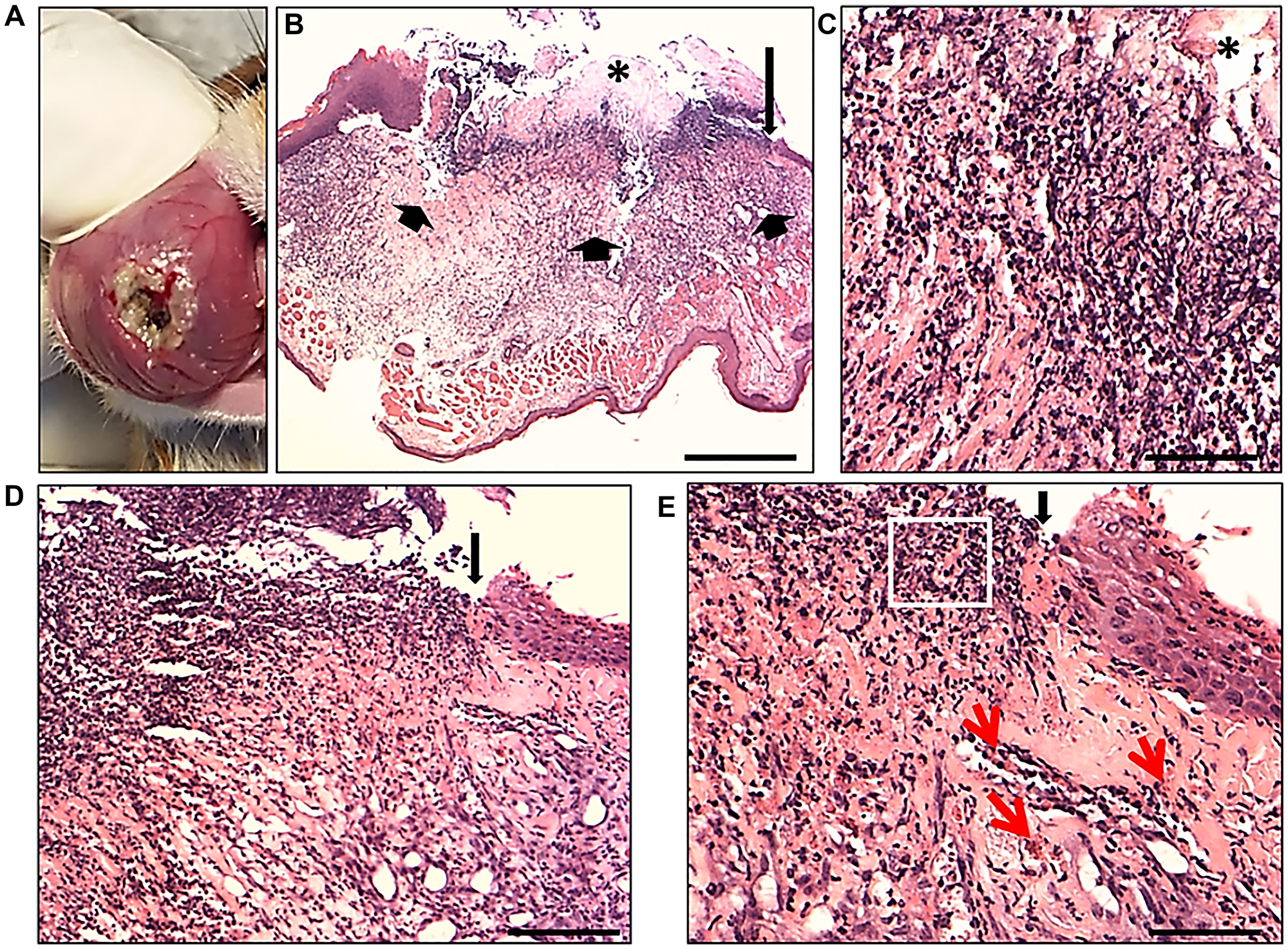 Representative micrographs of the macroscopic lesion of oral mucositis and histology of the OM ulceration produced in an experimental hamster model 7 days after 5-FU administration and scratch