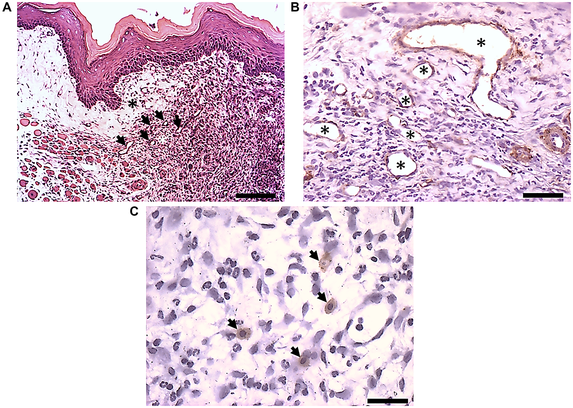 Immunohistochemistry of α-SMA and F4/80 positive cells