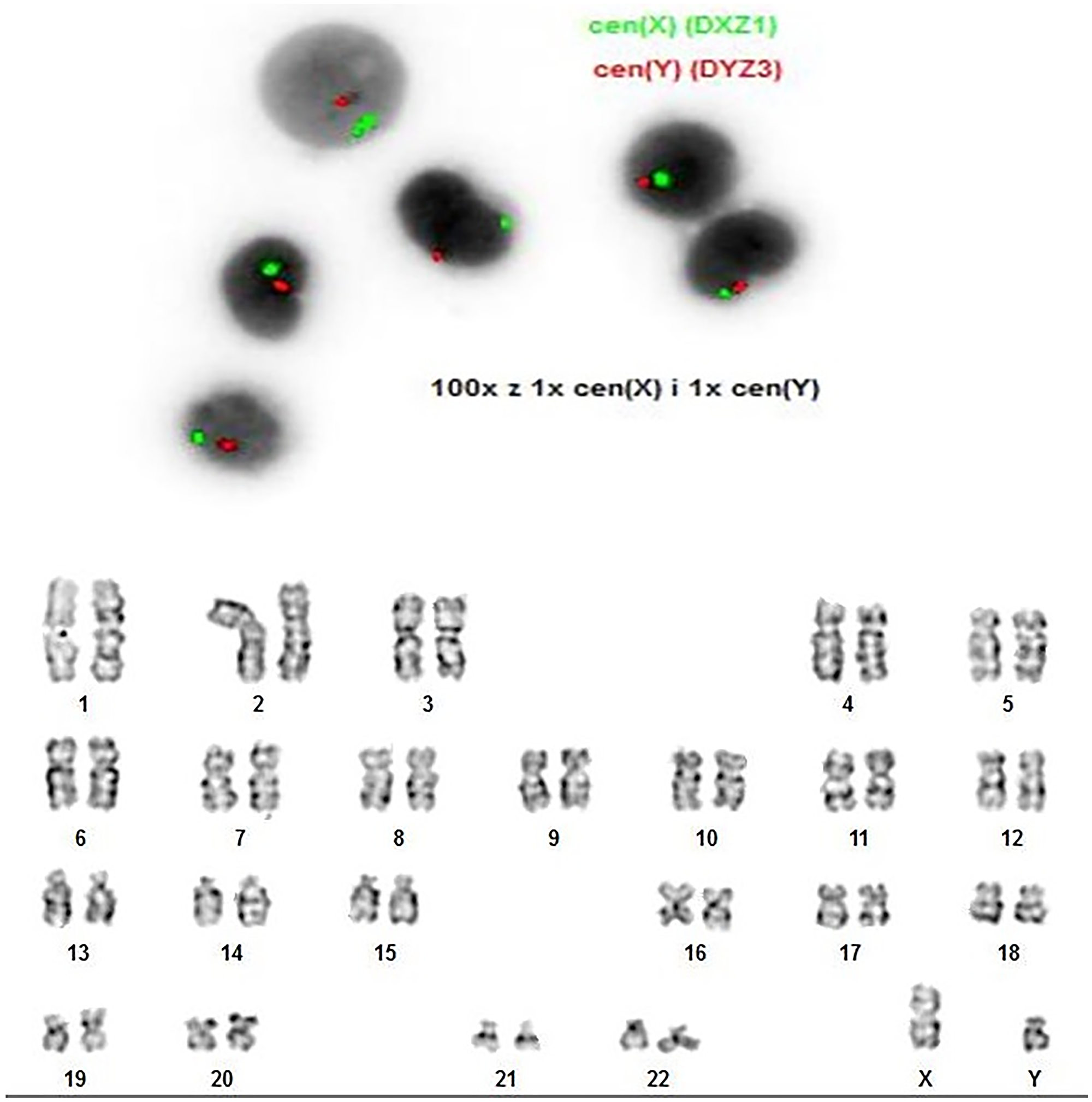 FISH of the sex chromosomes was carried out with the probe sets for the X centromere (CEPX – green) and Y centromere (CEPY – red)